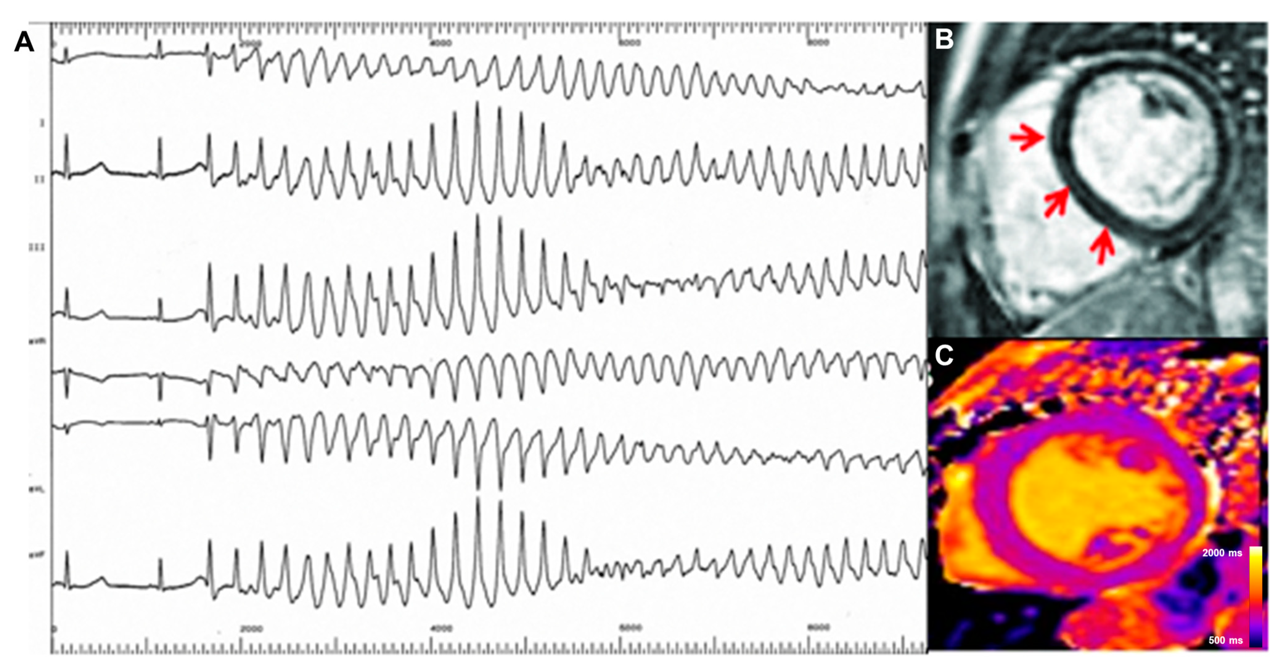 Medicina 60 00691 g004