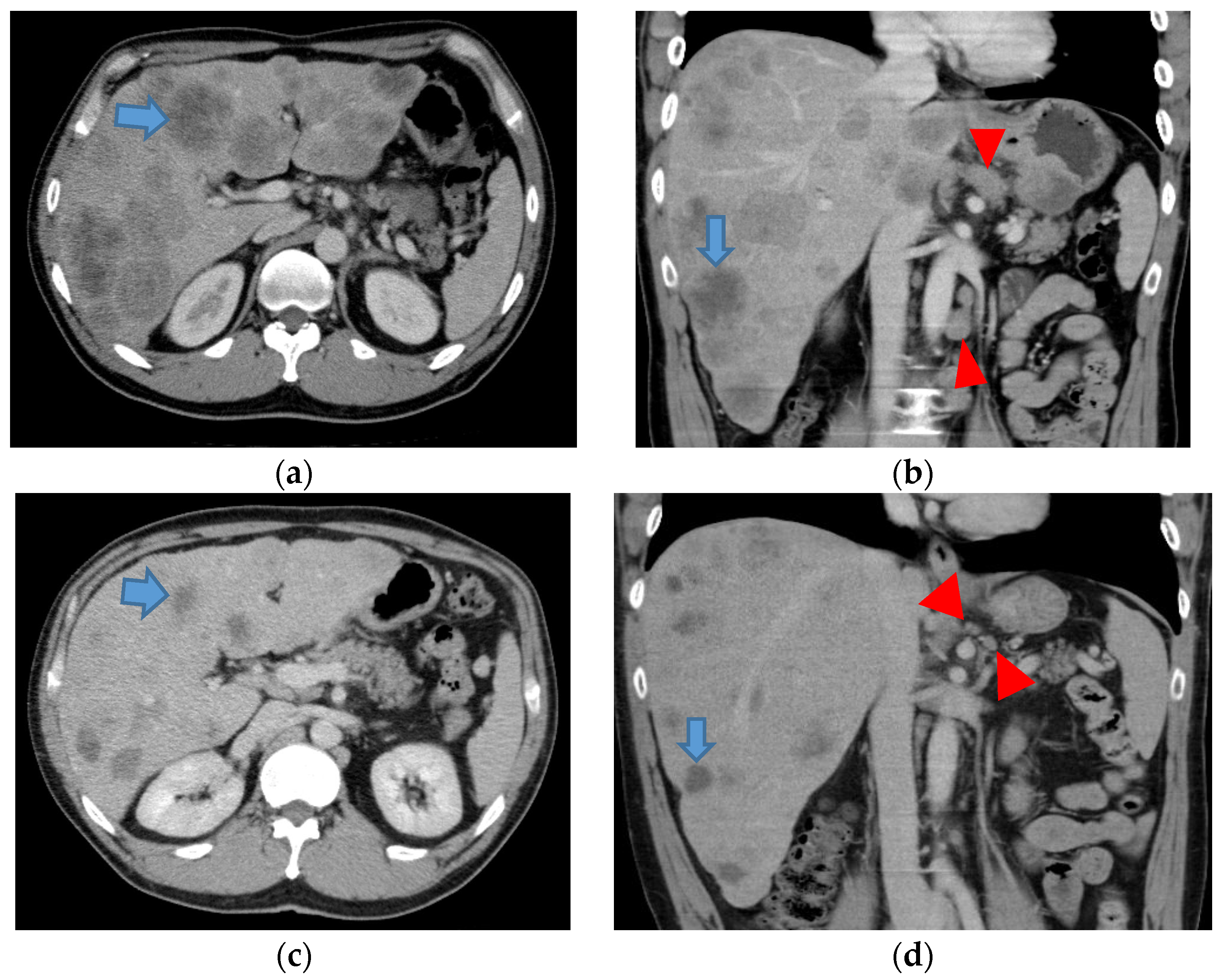 Medical Sciences Free FullText ChemoImmunotherapy