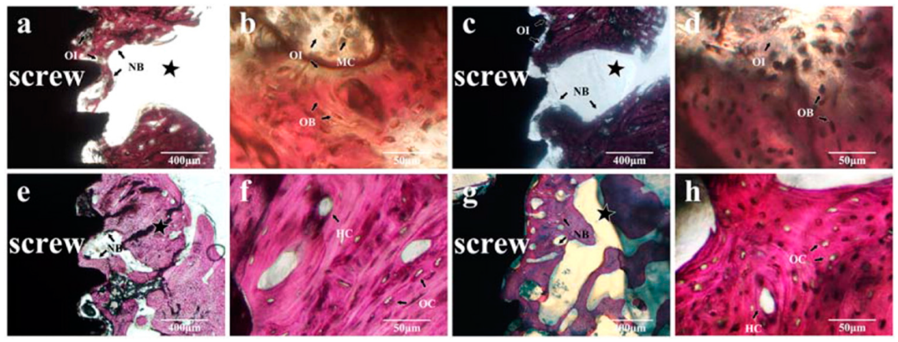 Metals 09 00302 g002