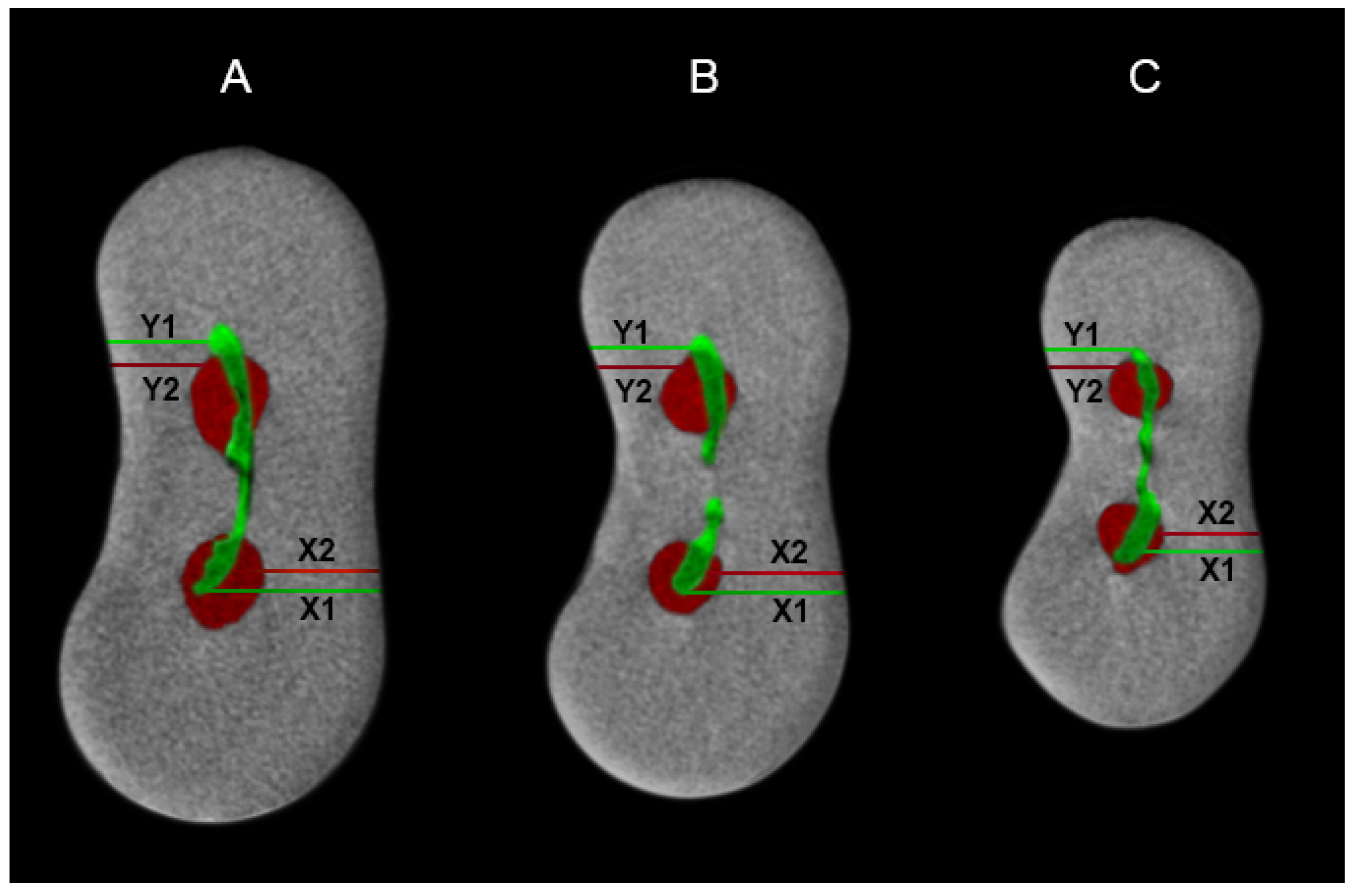Metals 10 00172 g001