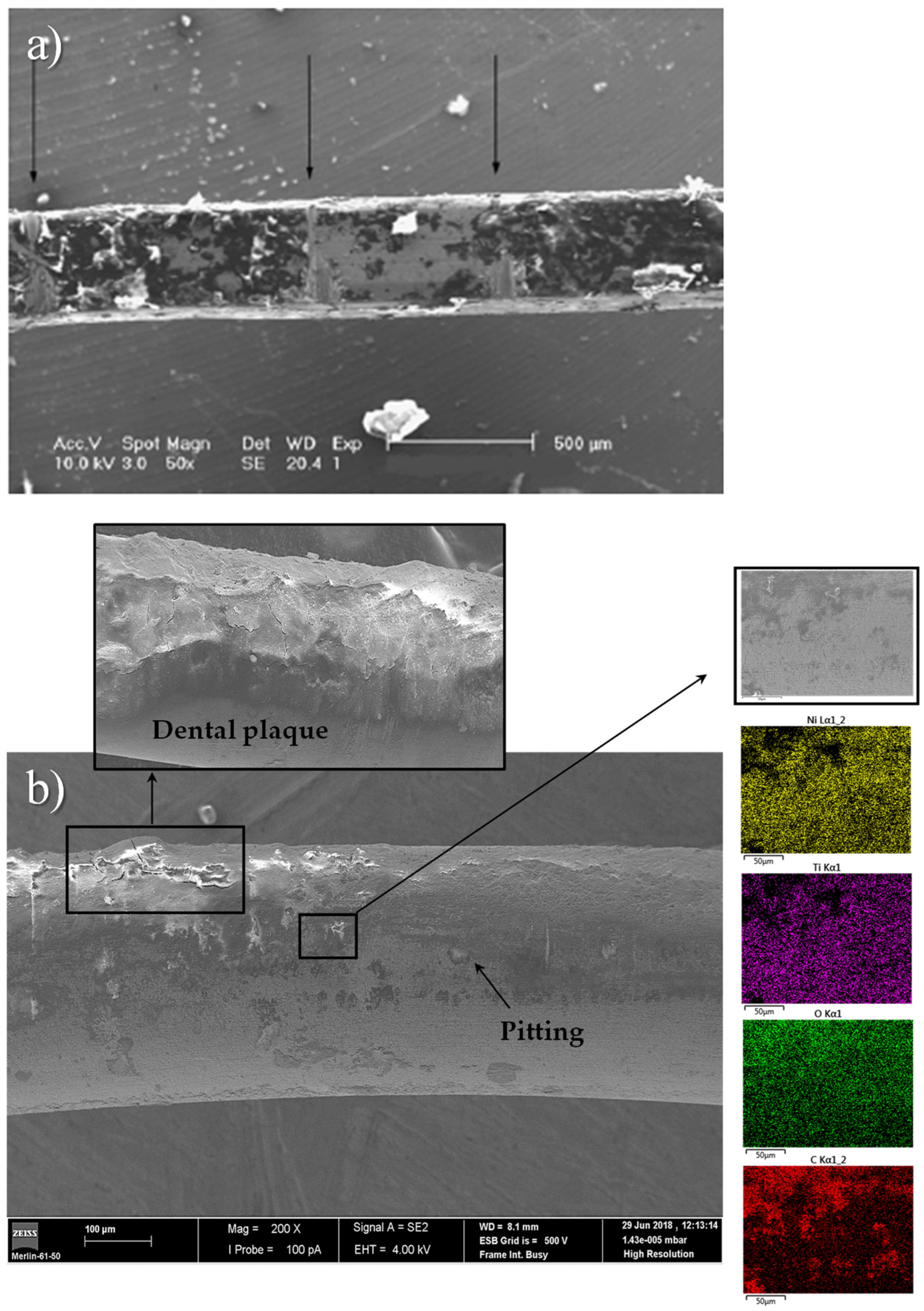 Metals 13 01955 g009