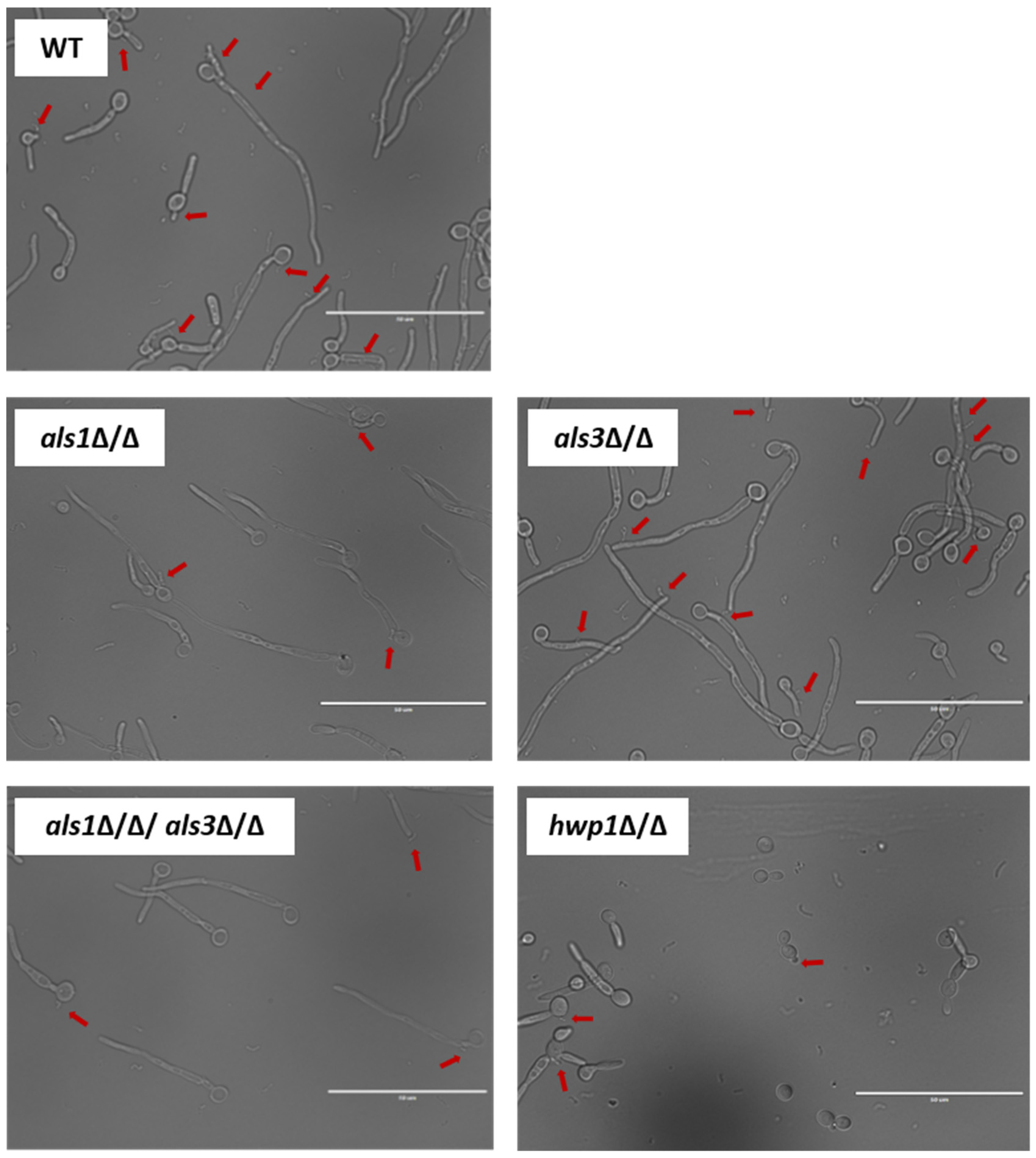 Microorganisms Free Full Text Candida Albicans Adhesins Als1 And