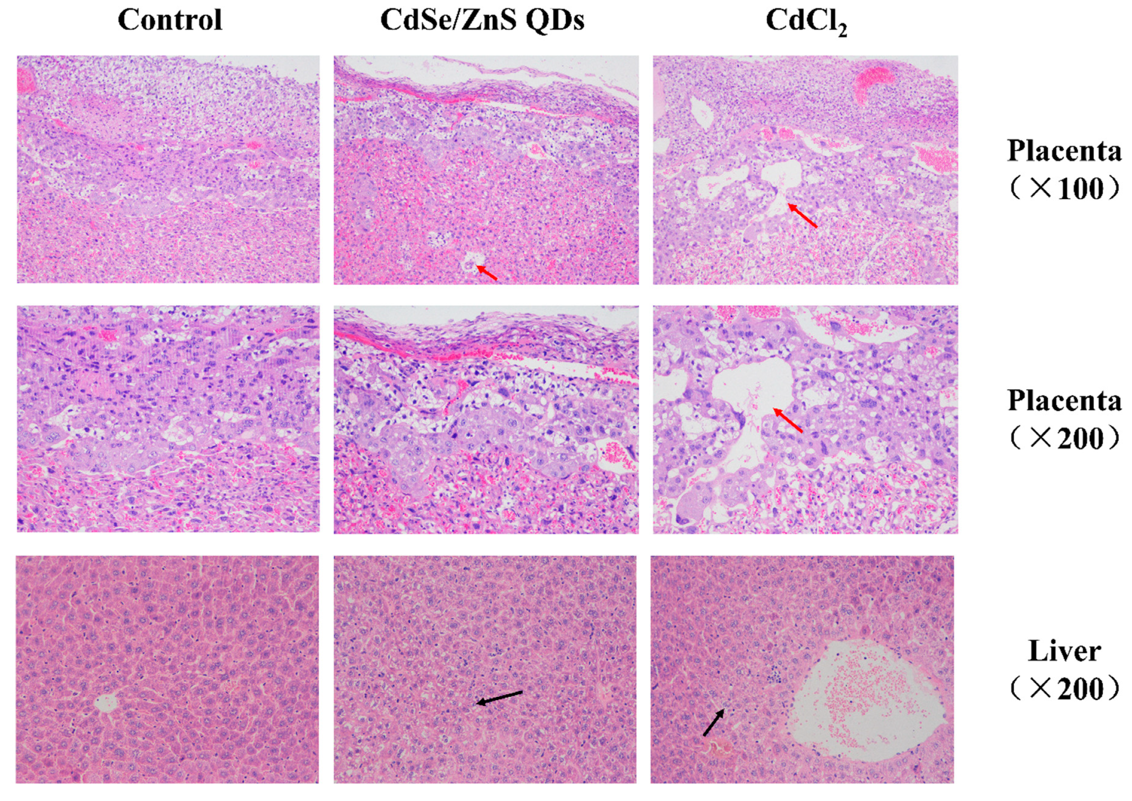 Nanomaterials 09 00257 g005