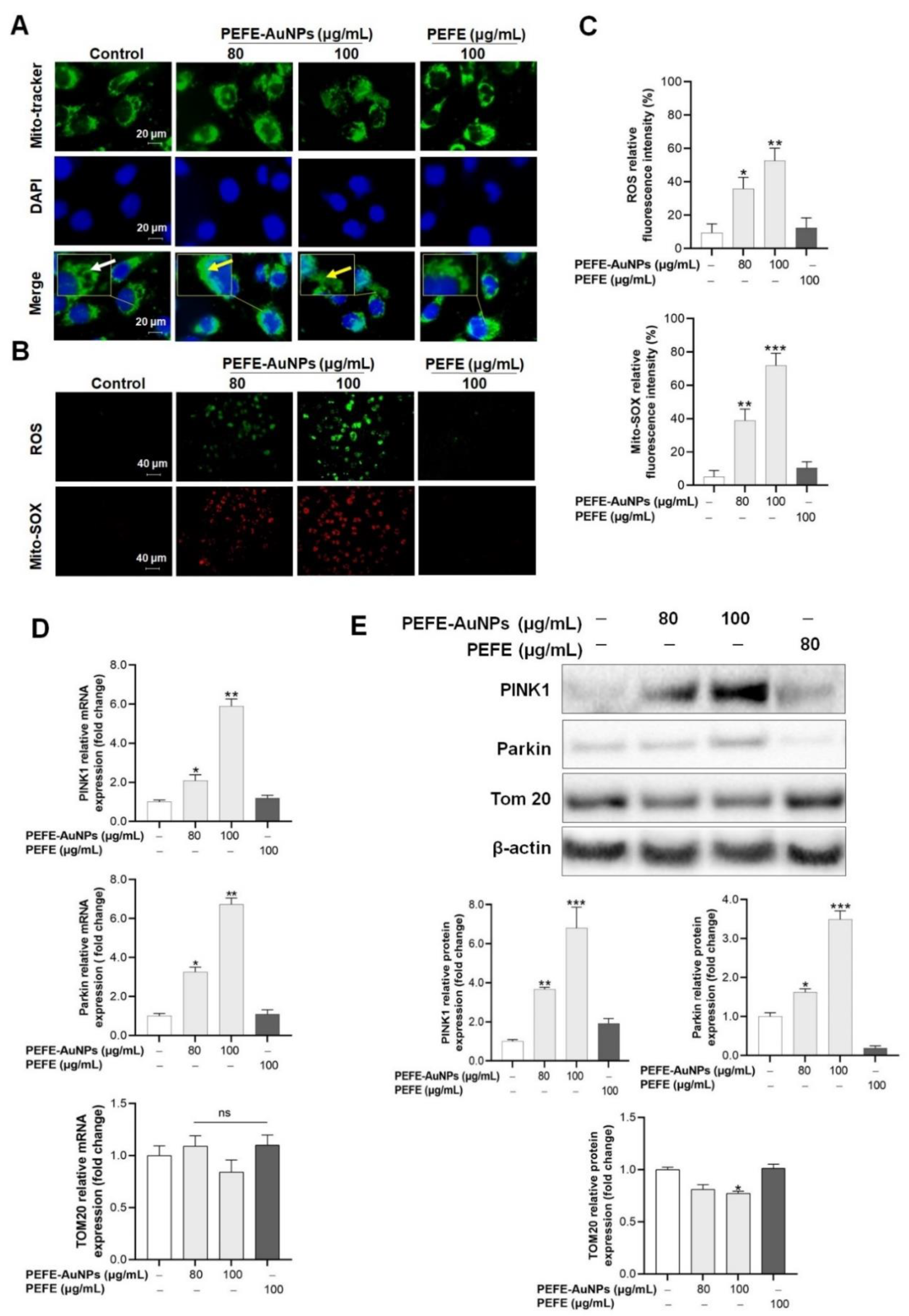 Nanomaterials 11 01260 g004