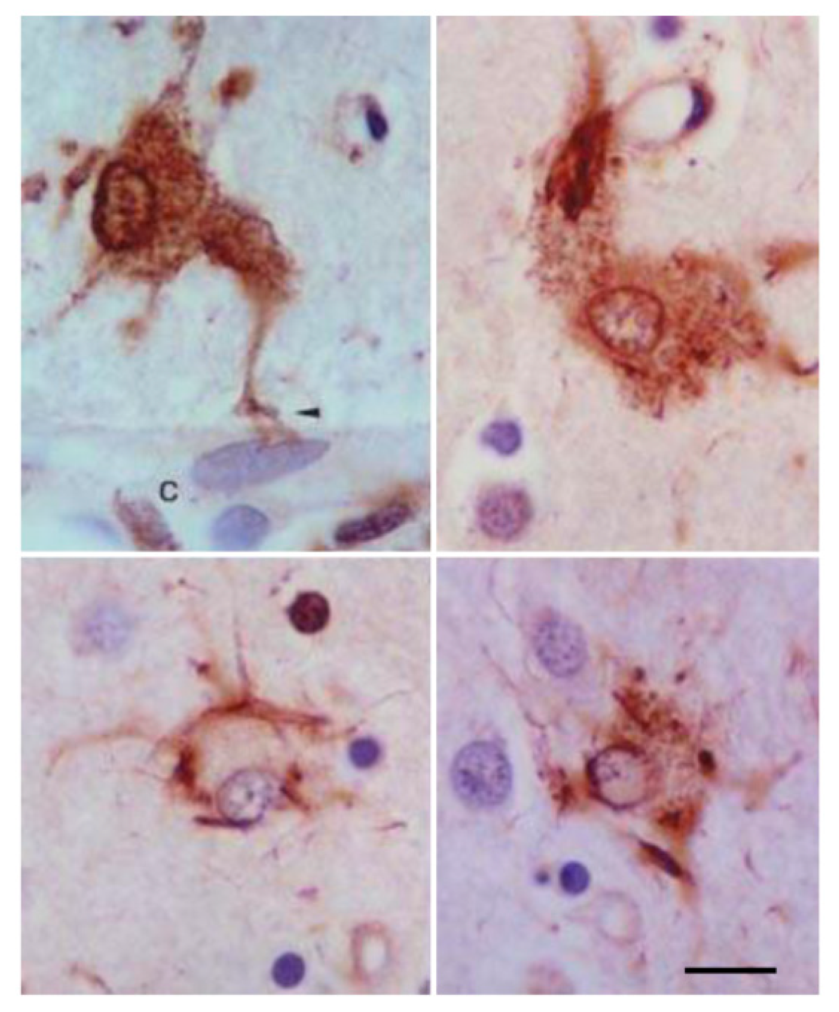 Neuroglia 01 00010 g002