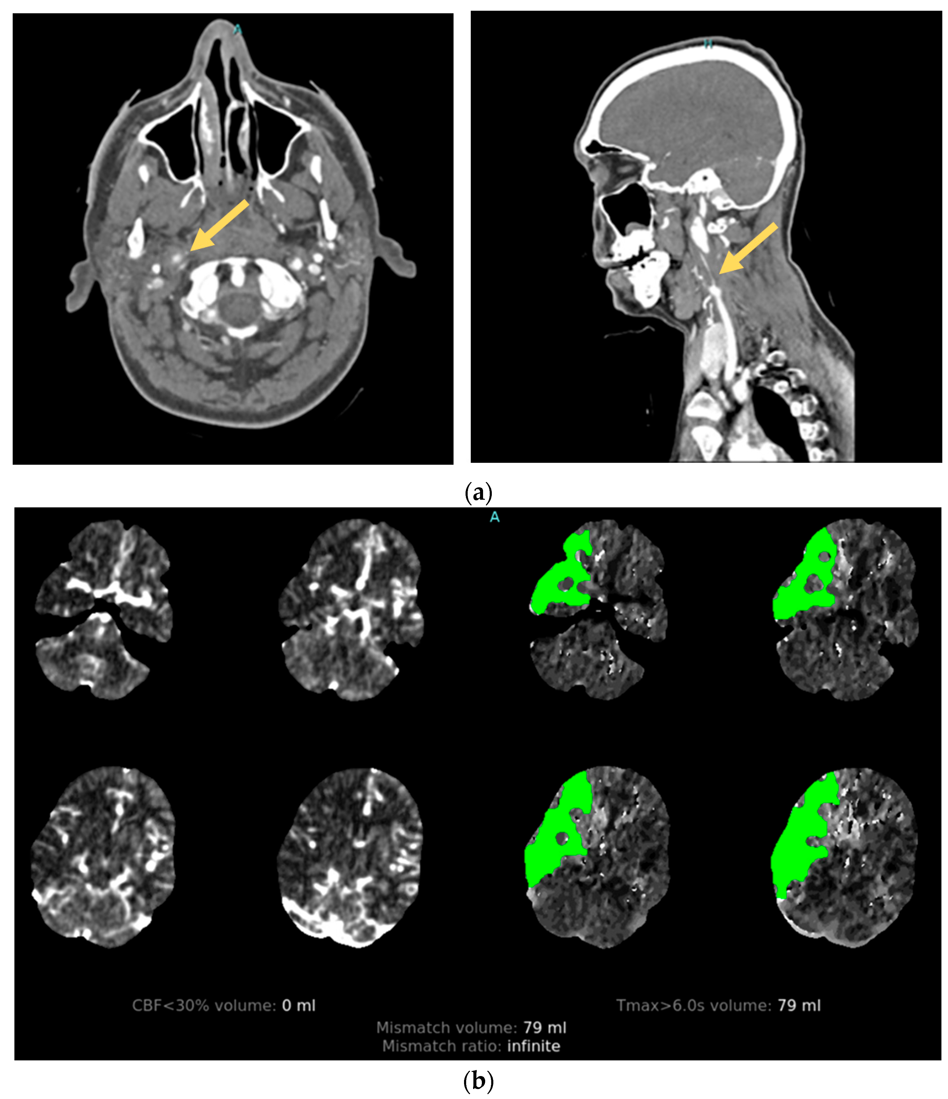 Neurolint 16 00006 g003
