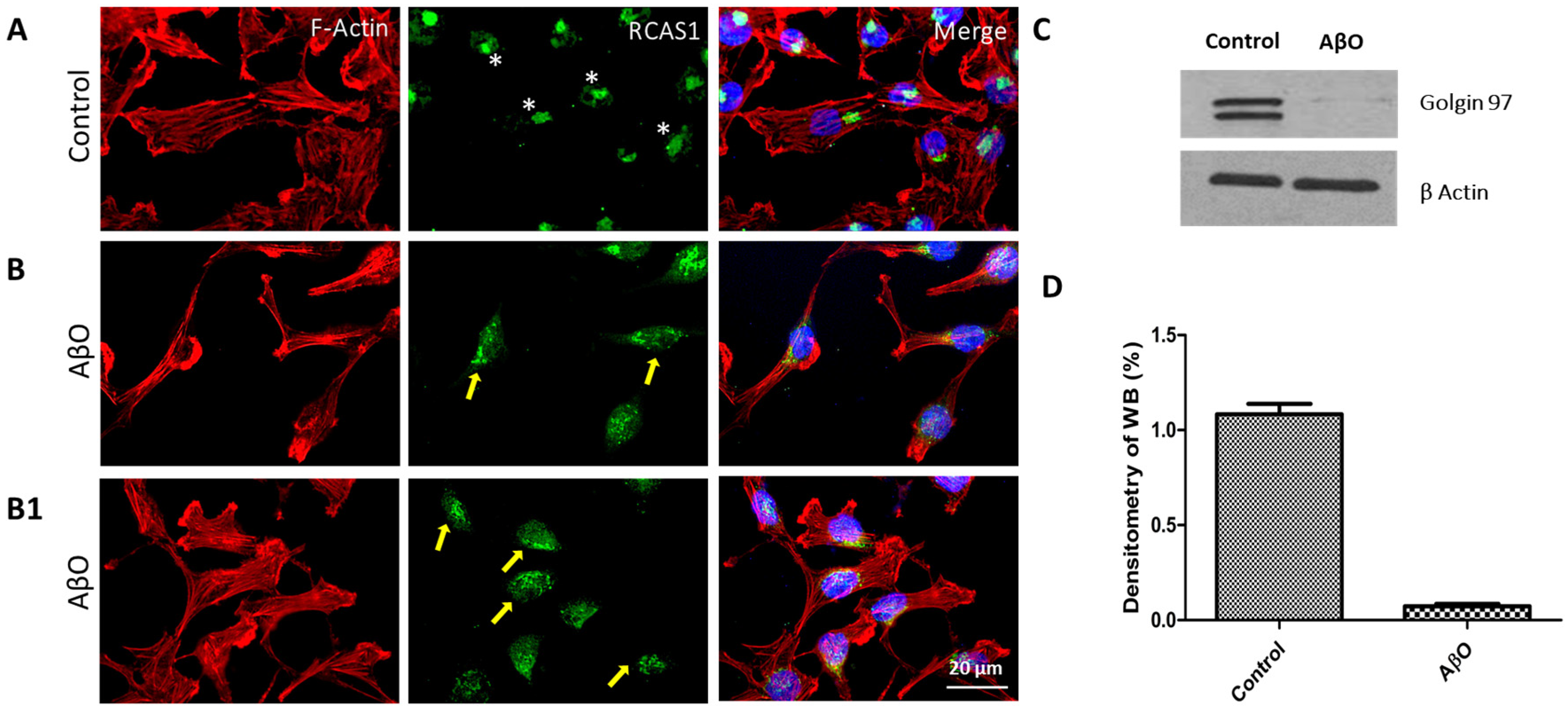 Neurosci Free Full Text Cytotoxic Effect Of Amyloid Oligomers