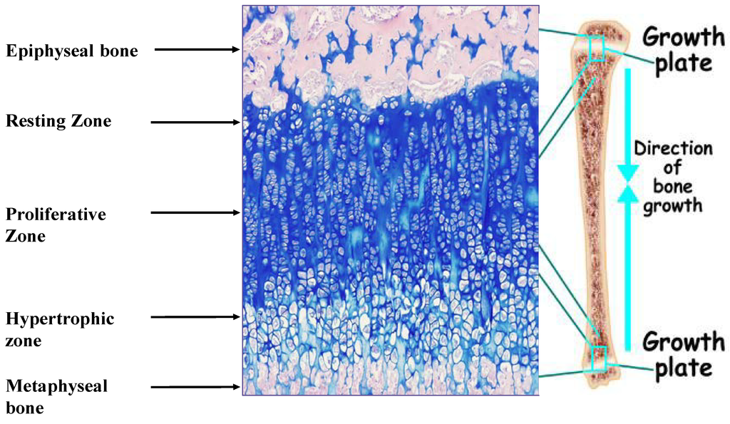 Epiphyseal Growth Plate Hot Sex Picture 4105