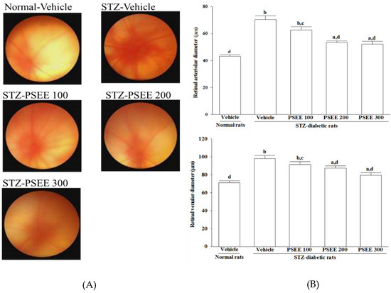 Antioxidant-Rich Extract from Plantaginis Semen Ameliorates Diabetic Retinal Injury in a Streptozotocin-Induced Diabetic Rat Model Antioxidant-Rich Extract from Plantaginis Semen Ameliorates Diabetic Retinal Injury in a Streptozotocin-Induced Diabetic Rat Model