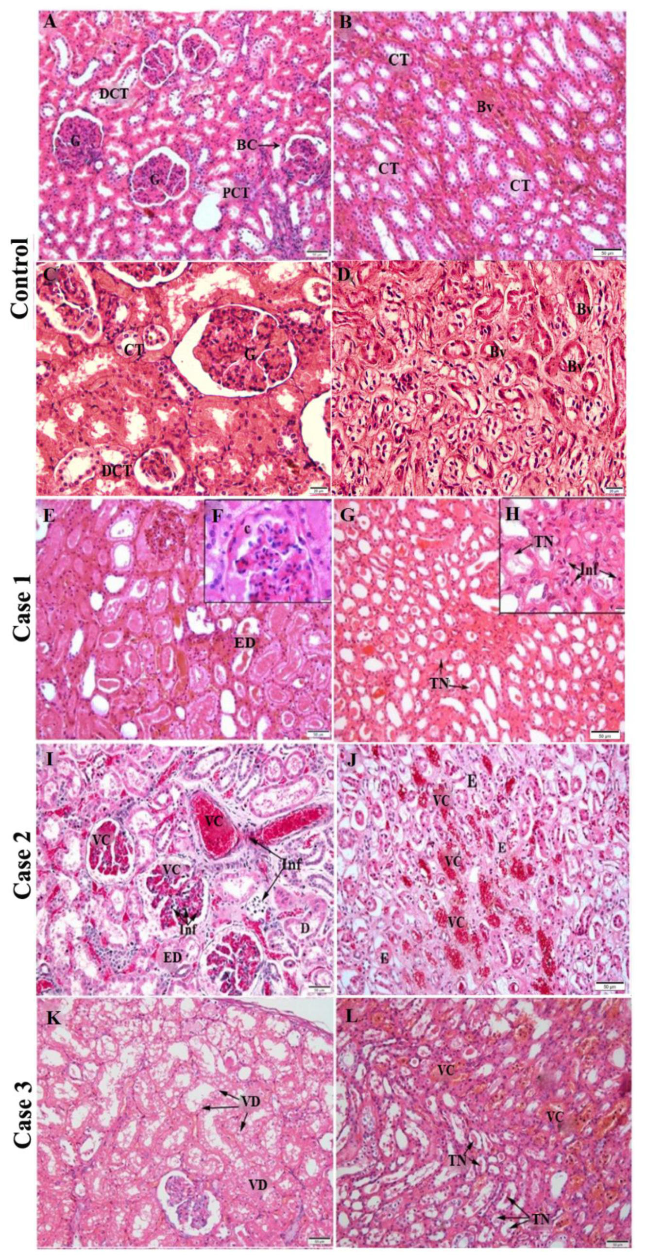 Pathogens 11 01543 g001