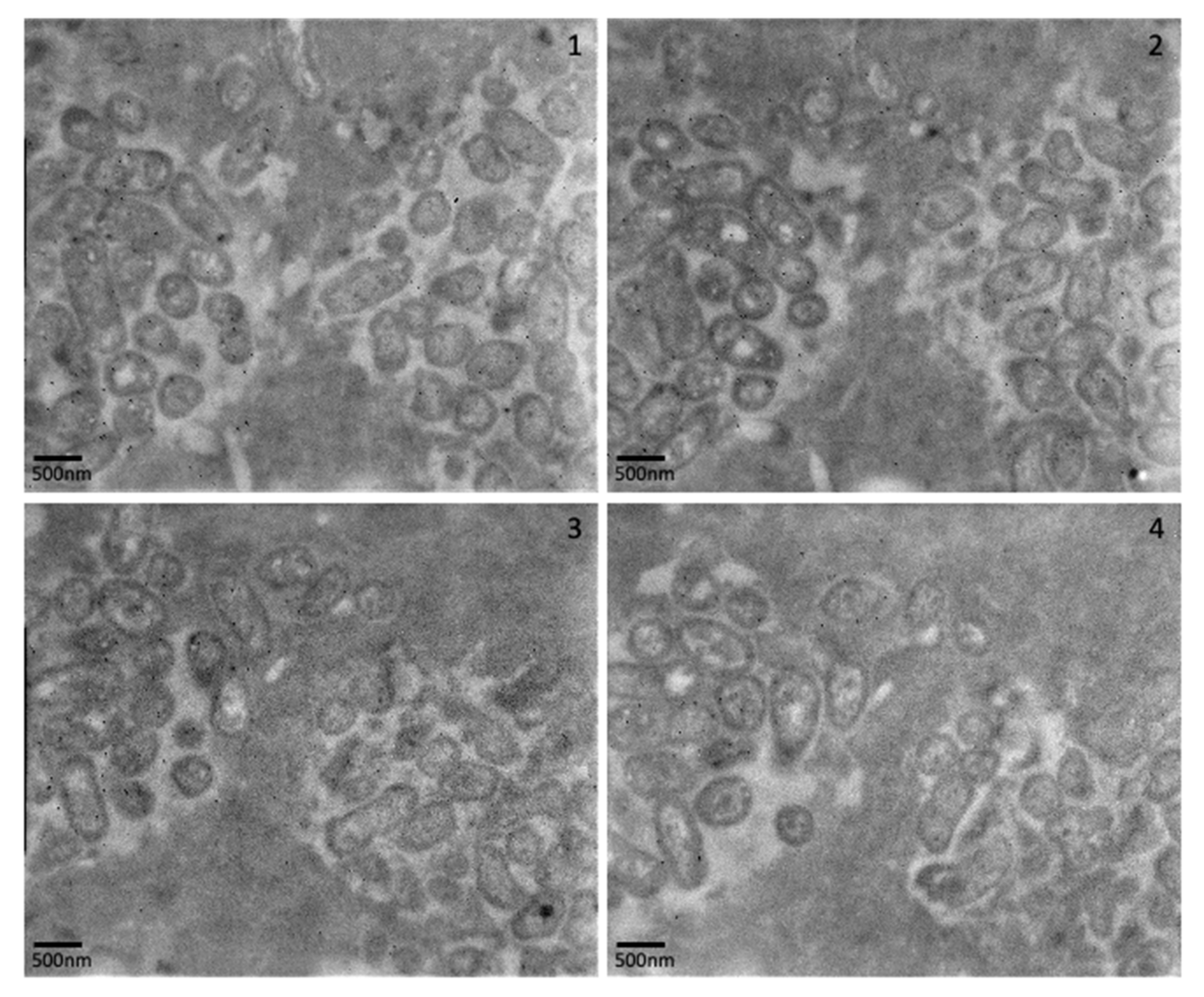 Pathogens 12 00118 g008 Pathogens 12 00118 g008