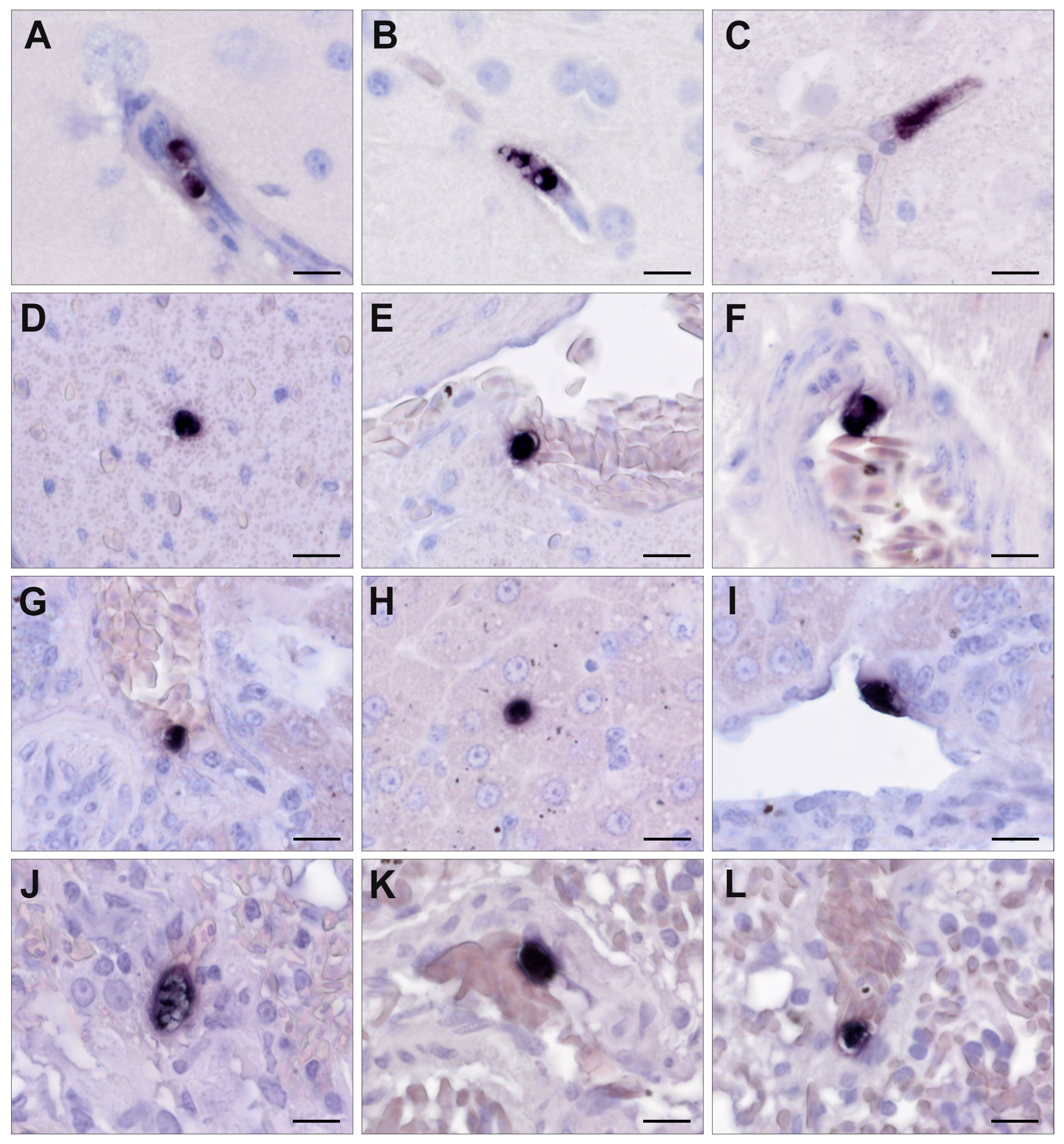 Pathogens 13 00337 g006