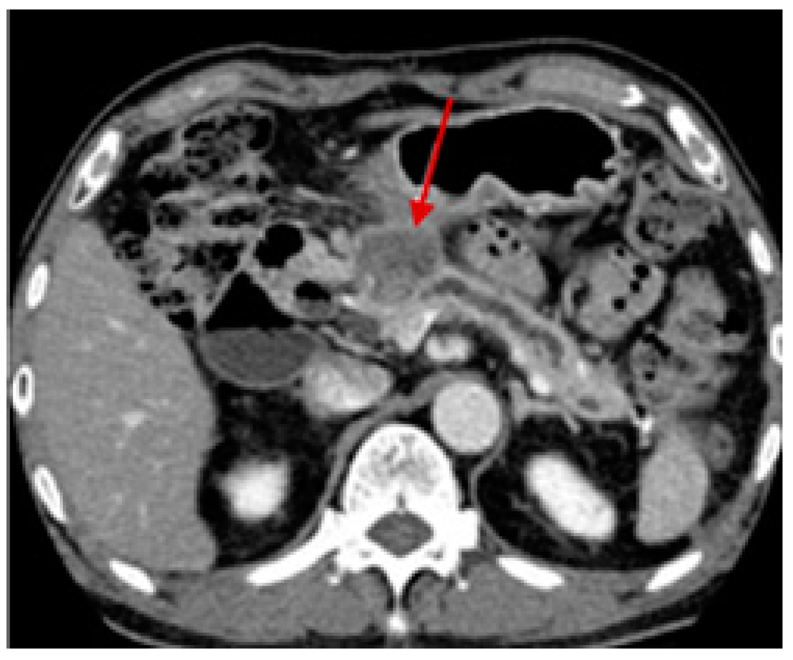 Pharmaceutics 15 02363 g003