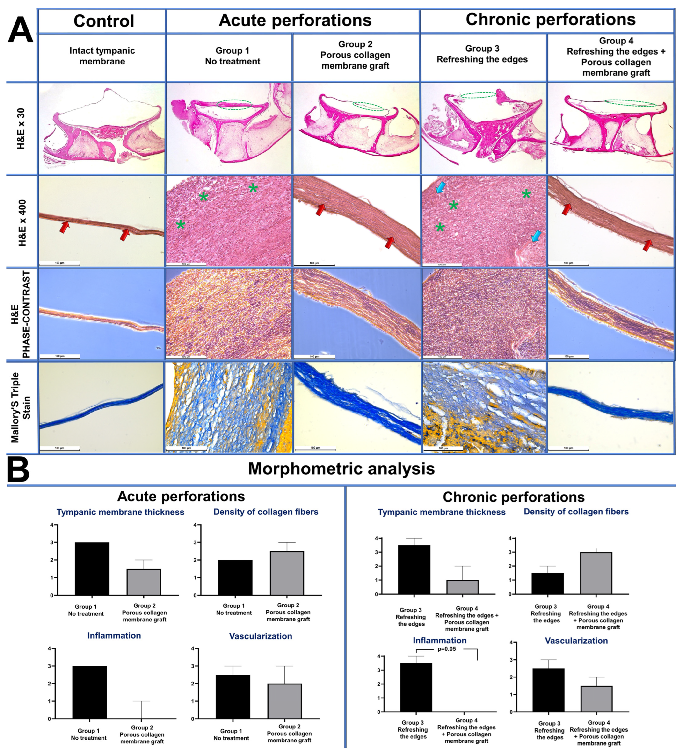 Polymers 16 00248 g004