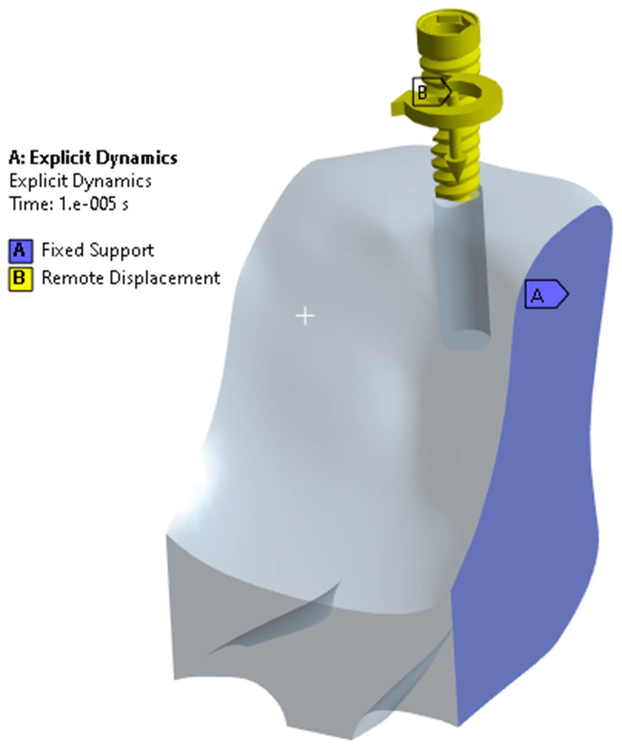 Prosthesis 06 00023 g004