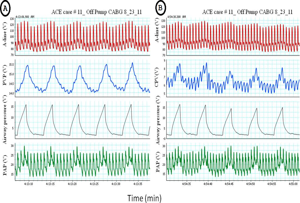 Sensors 12 02236f3 1024