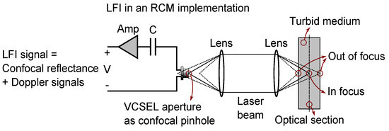 Concurrent Reflectance Confocal Microscopy and Laser Doppler Flowmetry to Improve Skin Cancer Imaging: A Monte Carlo Model and Experimental Validation Concurrent Reflectance Confocal Microscopy and Laser Doppler Flowmetry to Improve Skin Cancer Imaging: A Monte Carlo Model and Experimental Validation