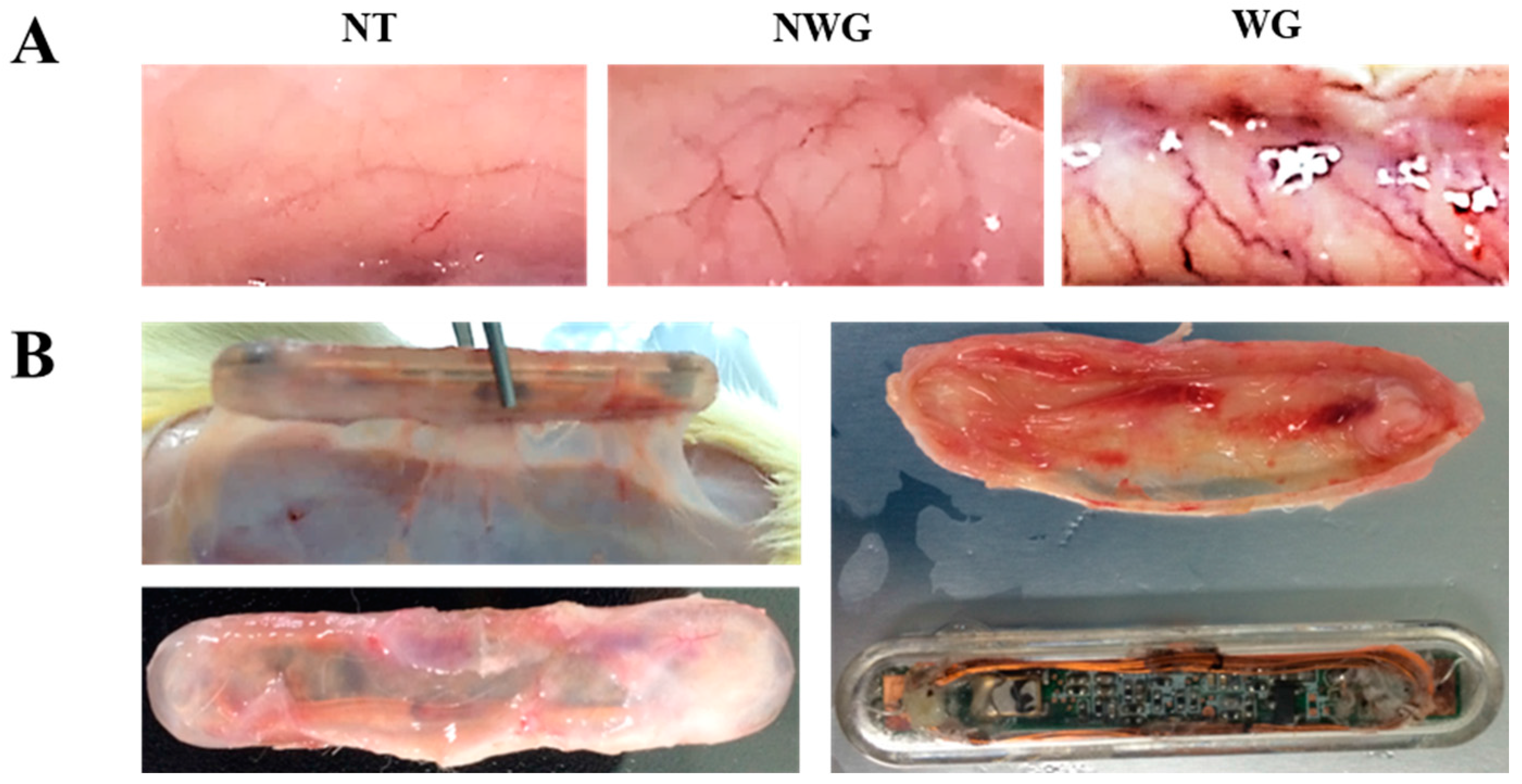 Sensors 17 02905 g002a