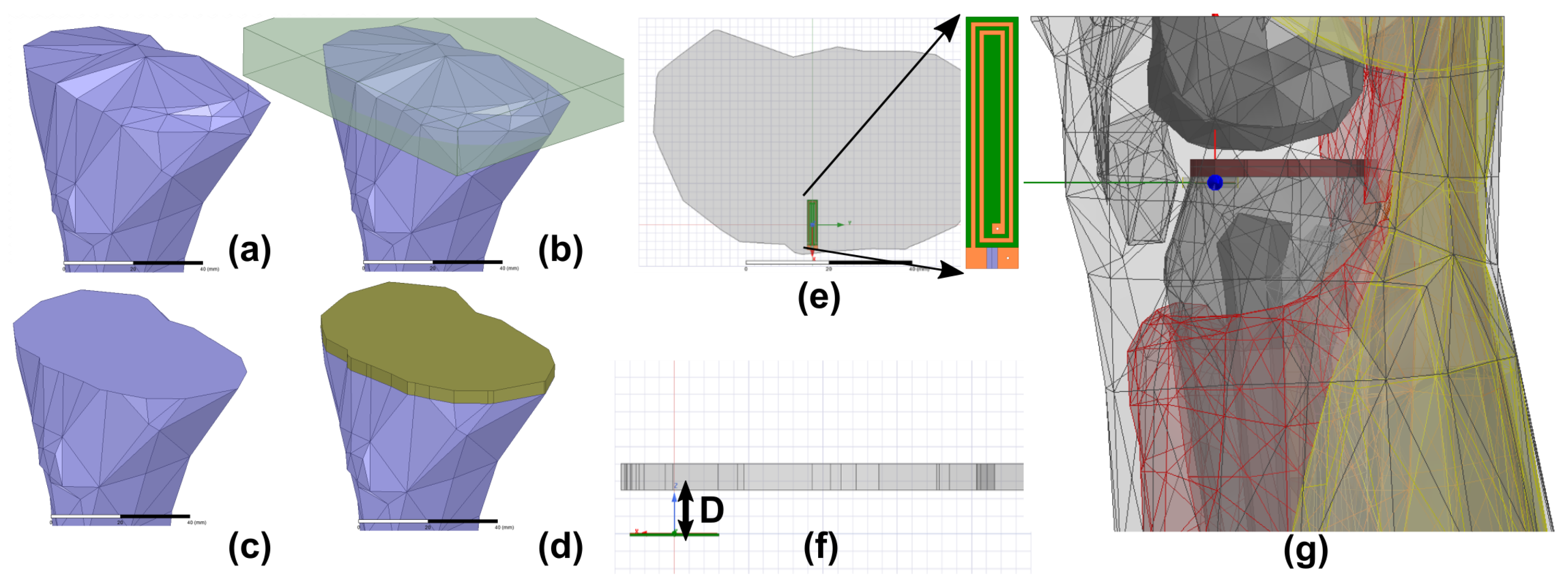 Sensors 18 03888 g002
