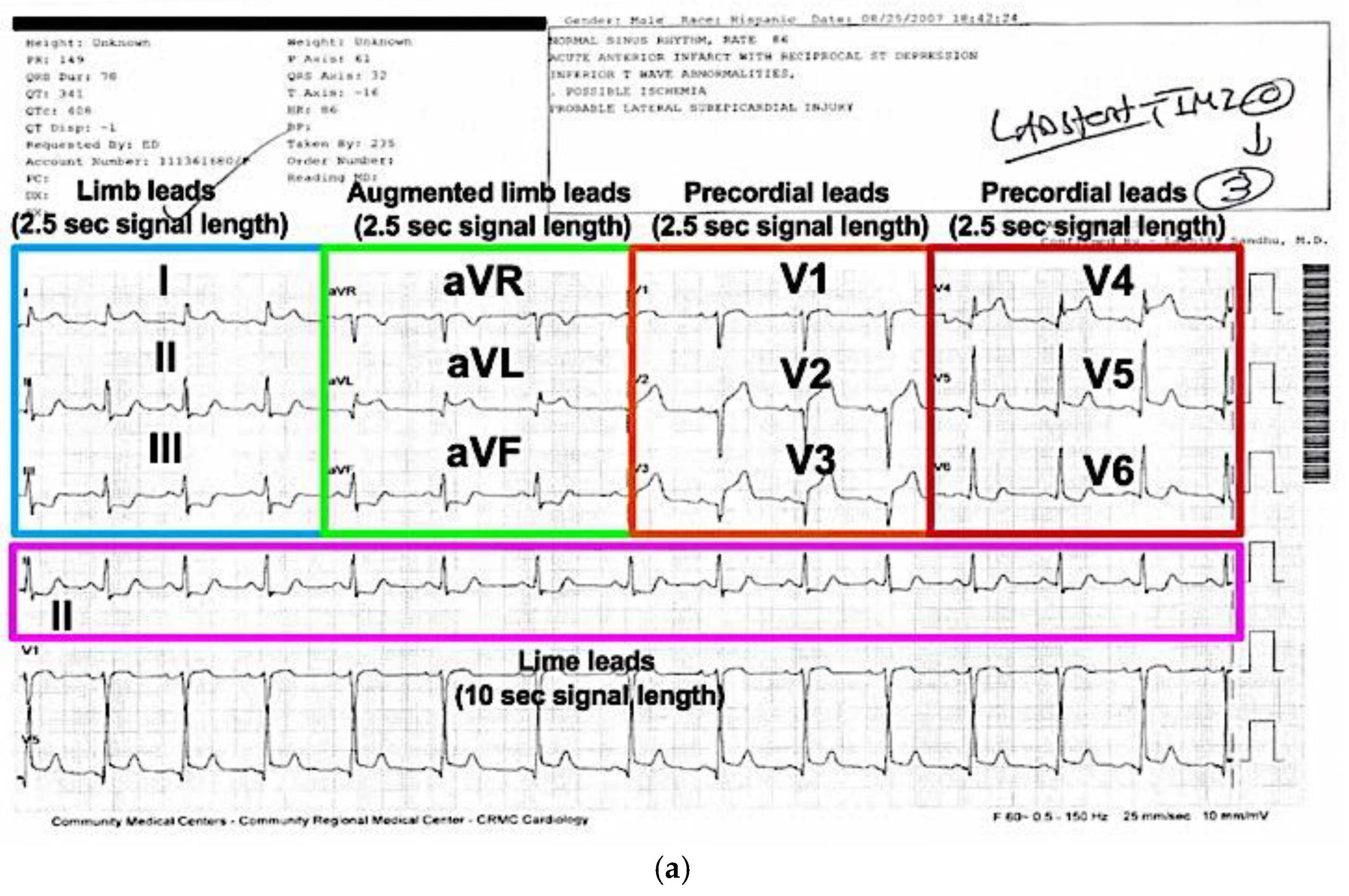 Sensors 20 03975 g002a