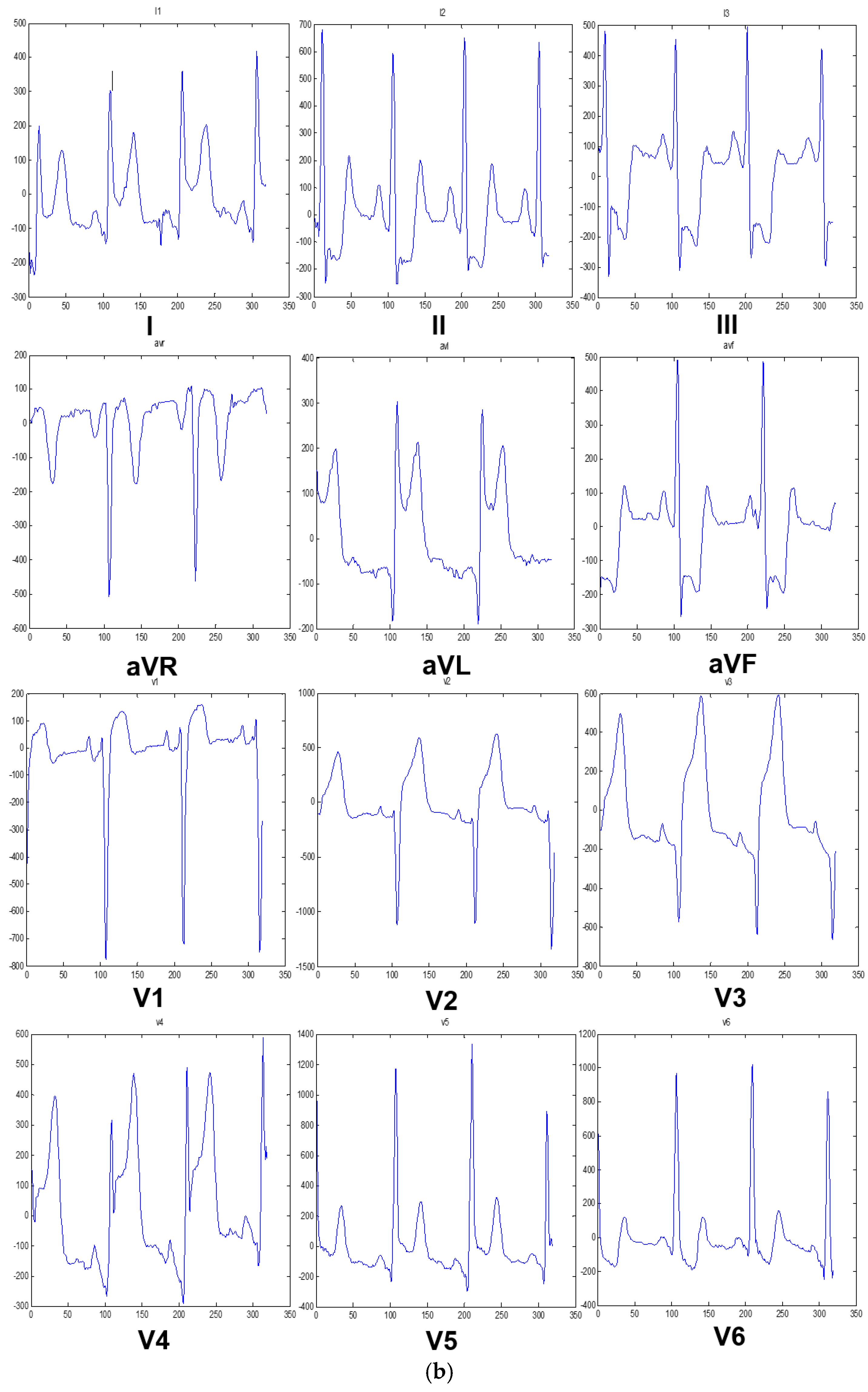 Sensors 20 03975 g002b