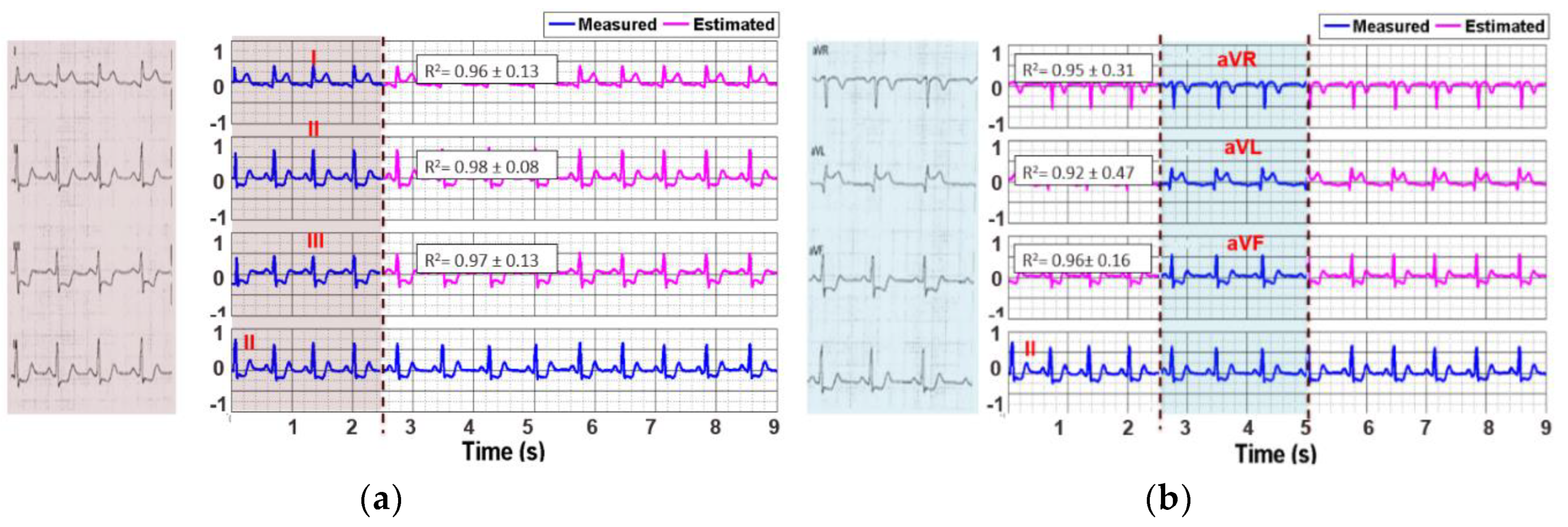 Sensors 20 03975 g006a