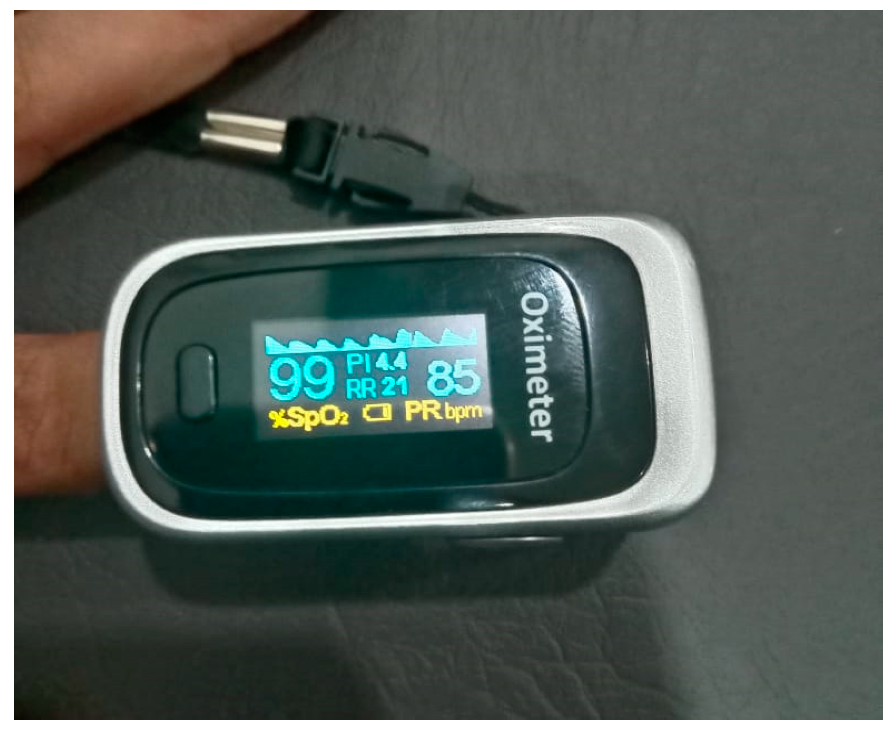 Sensors 21 04833 g007 Sensors 21 04833 g007