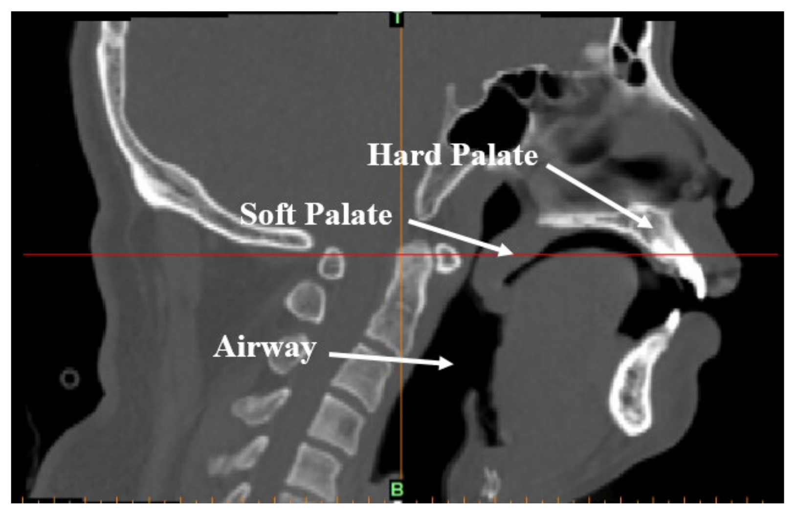 Sensors 21 07457 g002 Sensors 21 07457 g002