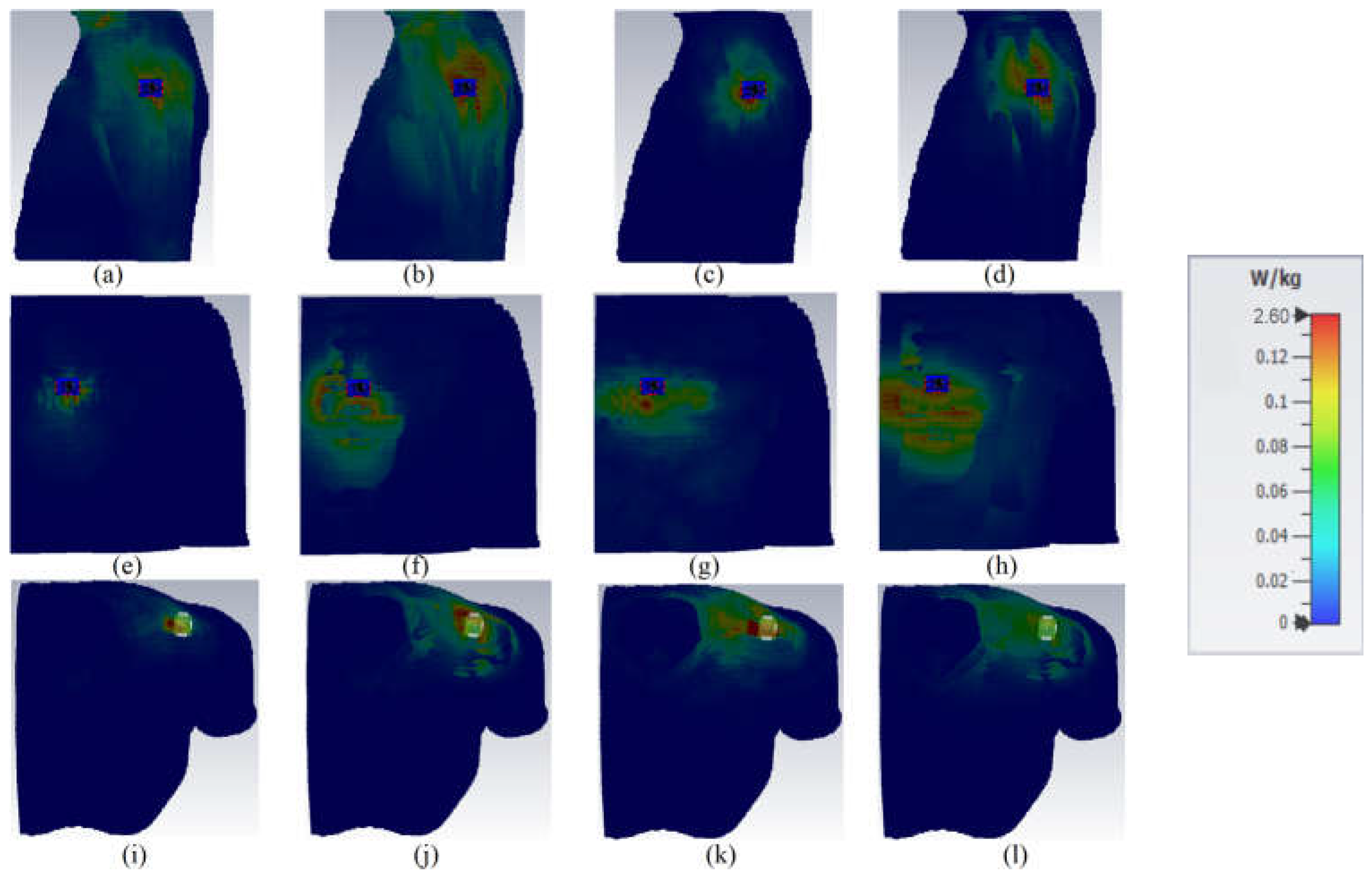Sensors 23 01997 g017
