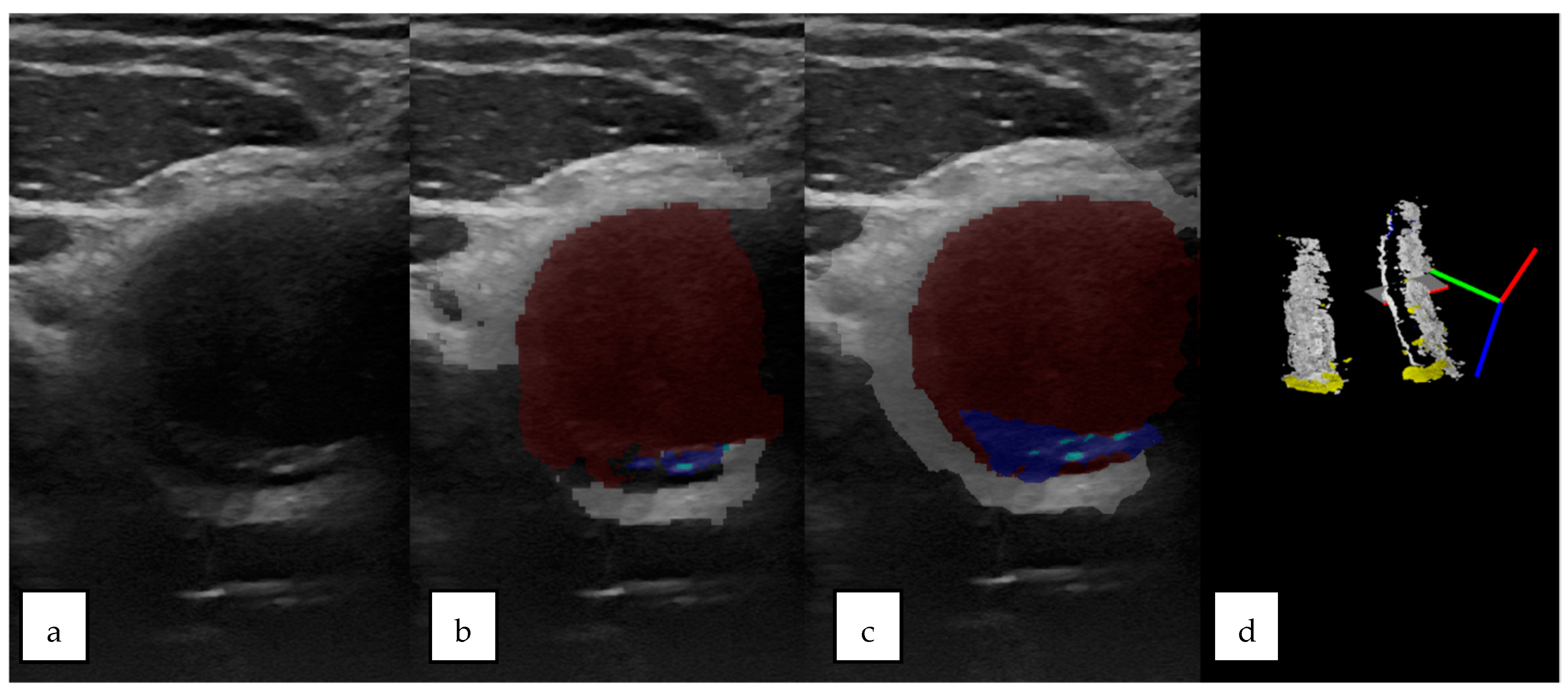 Sensors 23 02806 g004