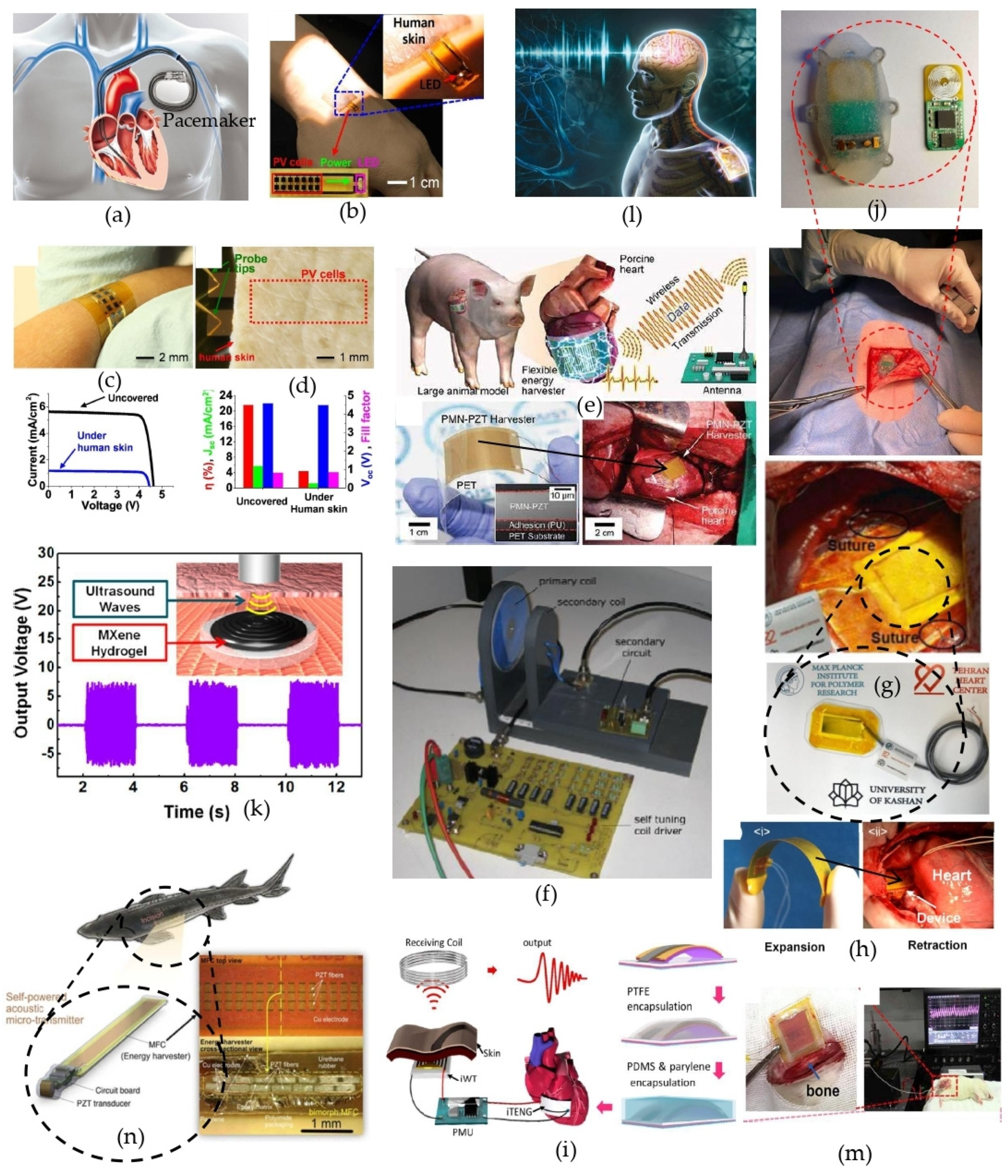Sensors 24 00163 g002