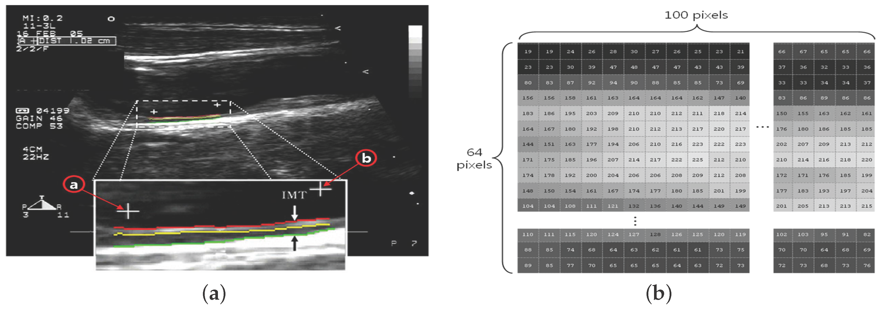 Symmetry 08 00047 g002a