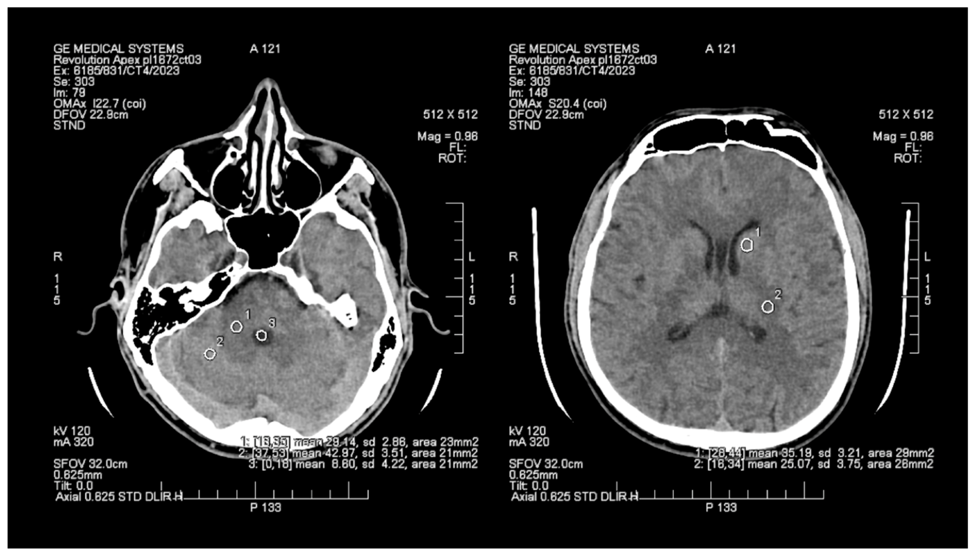 Tomography Free Full Text Image Quality Improvement In Deep