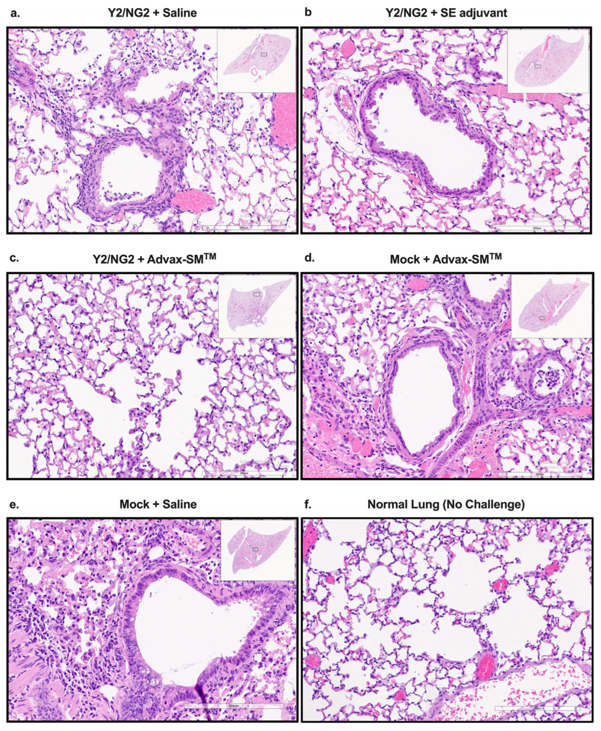 Vaccines 12 00455 g004