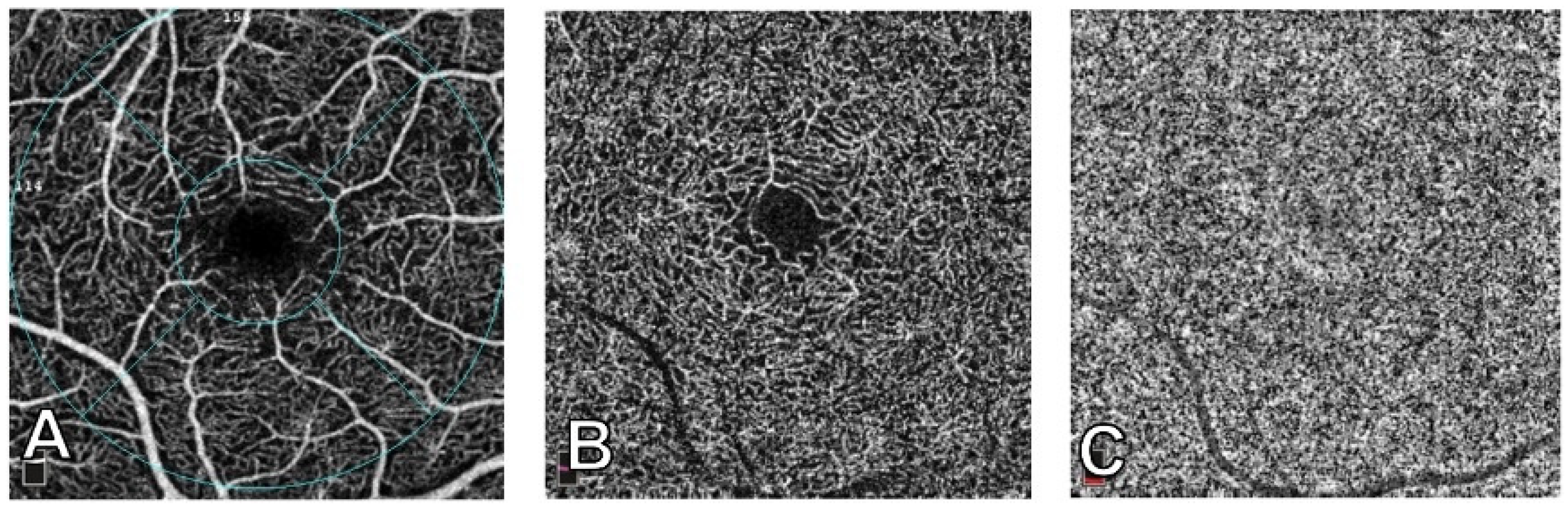 Vision 07 00064 g004