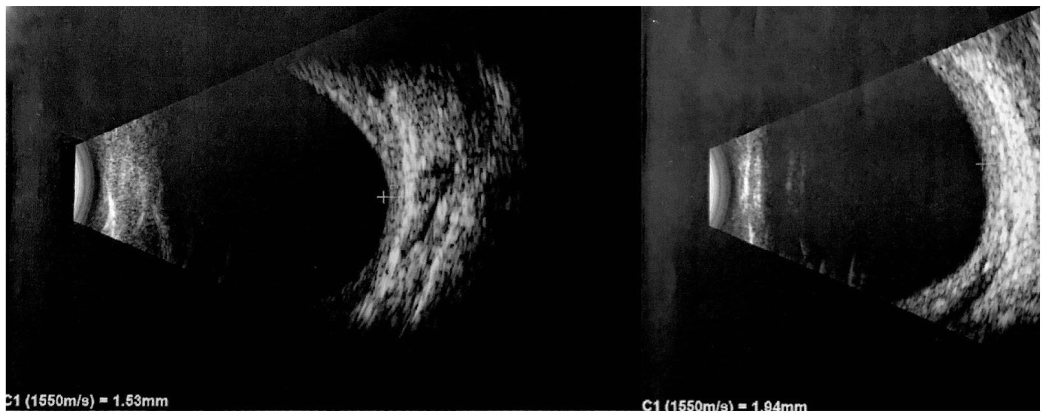 Vision 07 00064 g005