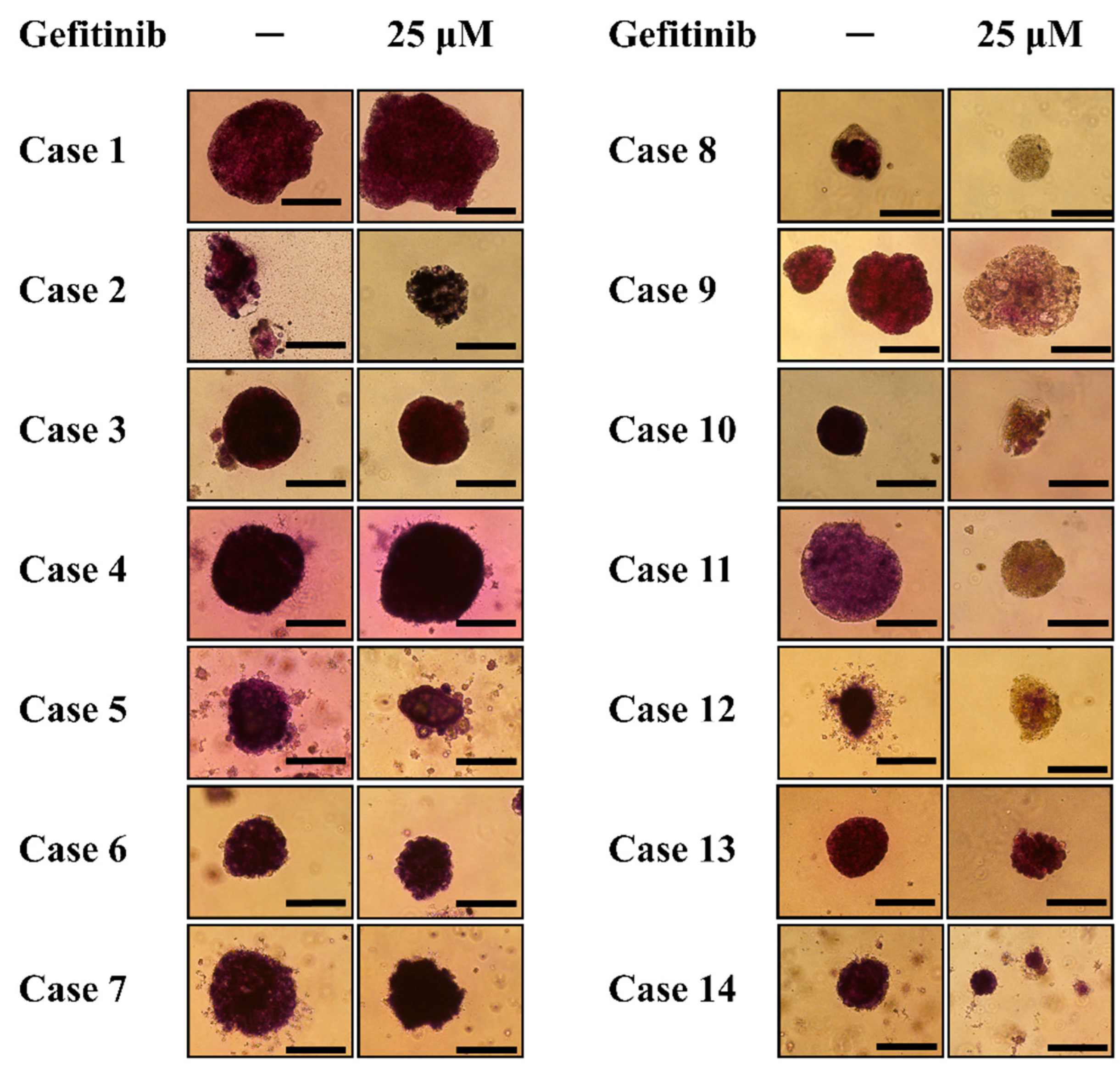 Diagnostics 14 00998 g005