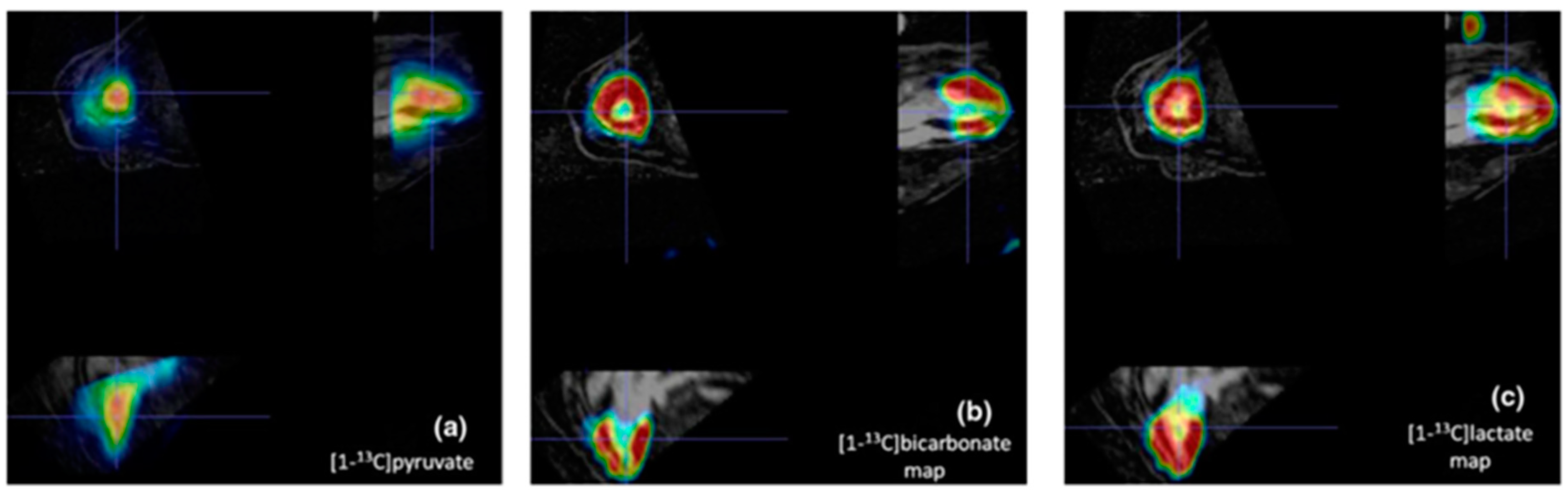 Diagnostics 14 01035 g006