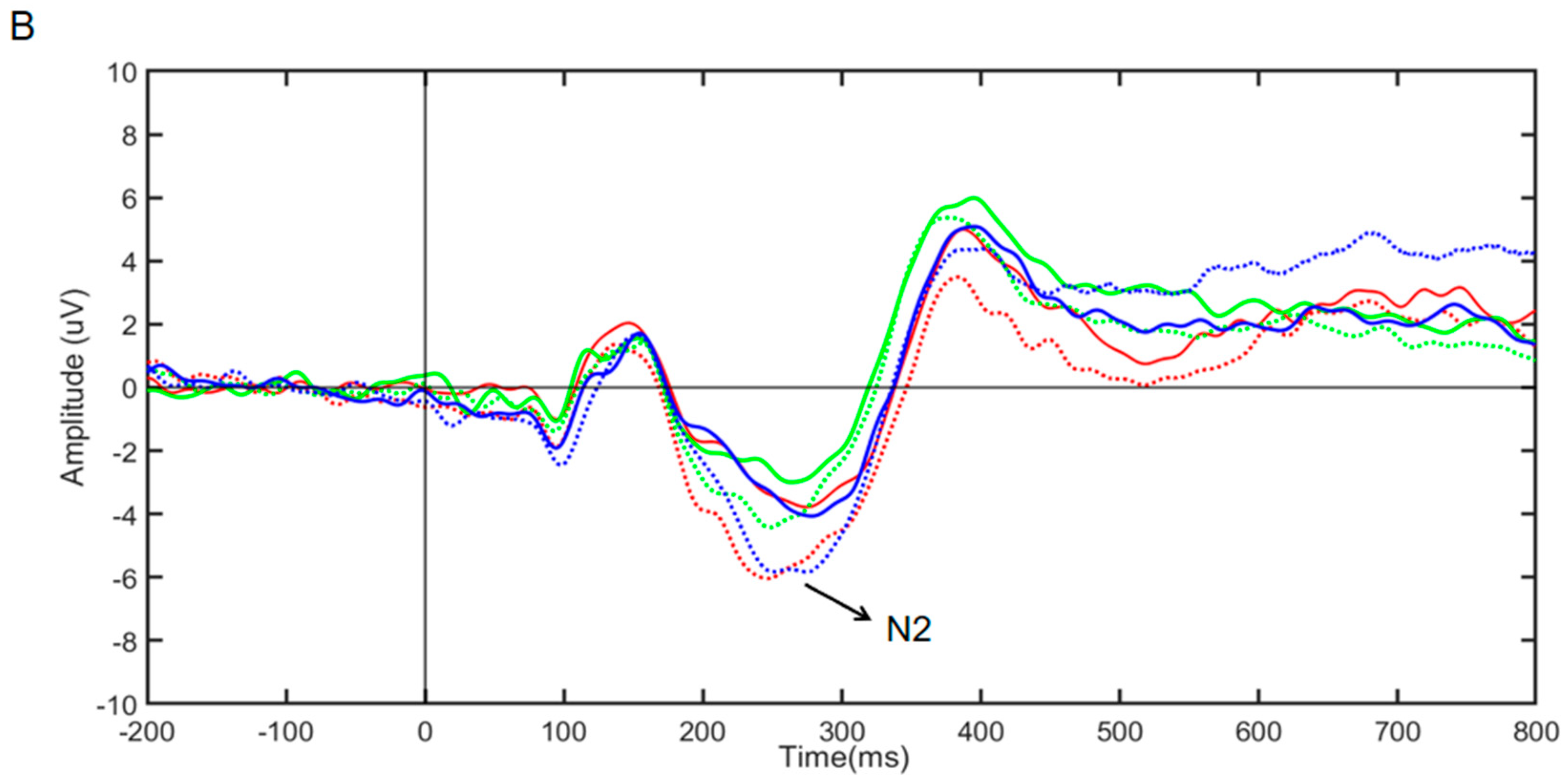 Brainsci 14 00506 g005b