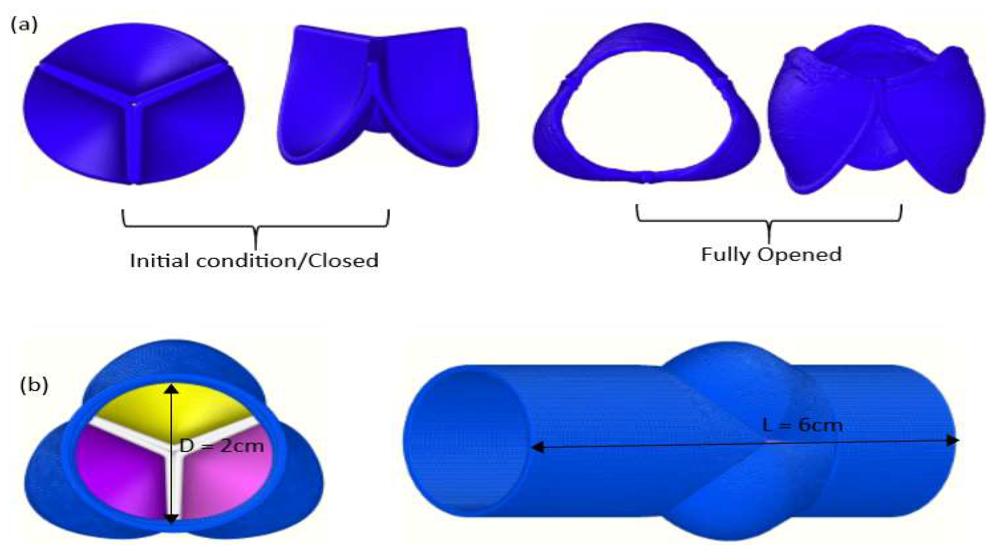 Mechanical finite element model of the human heart discretized with