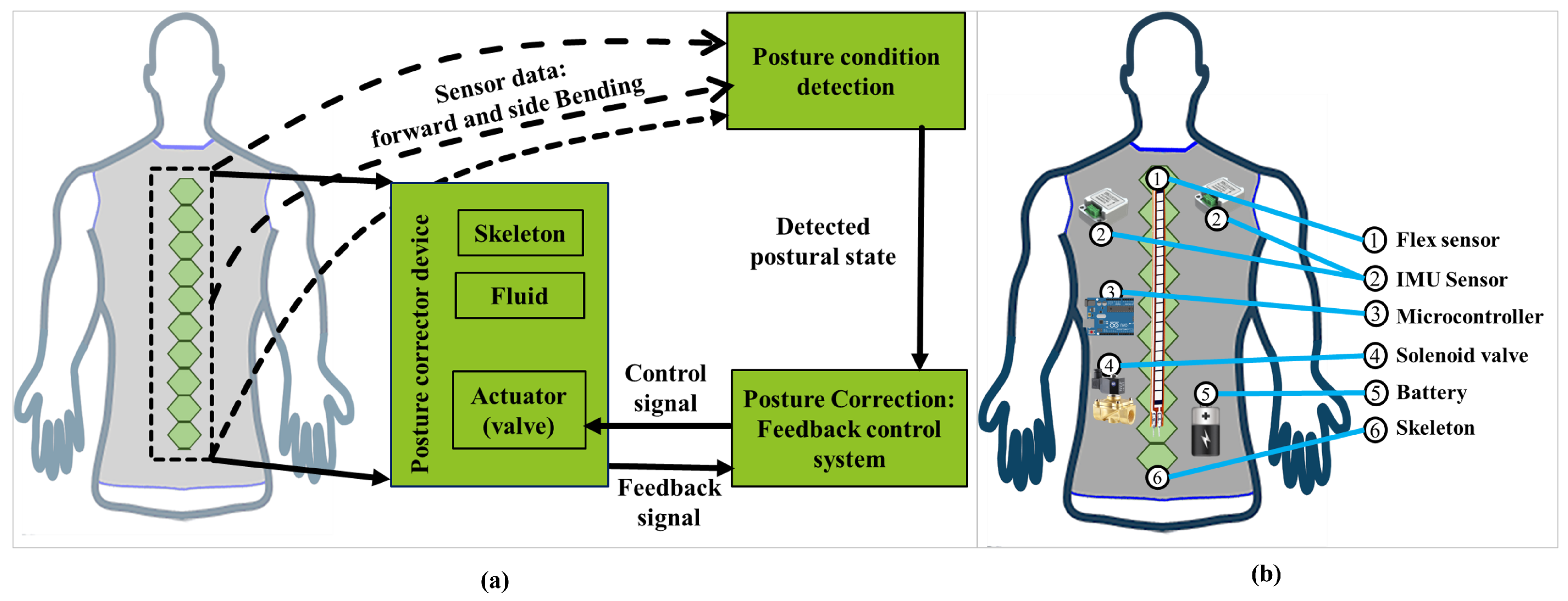 Actuators | Free Full-Text | Development of an Automatic Air-Driven  3D-Printed Spinal Posture Corrector