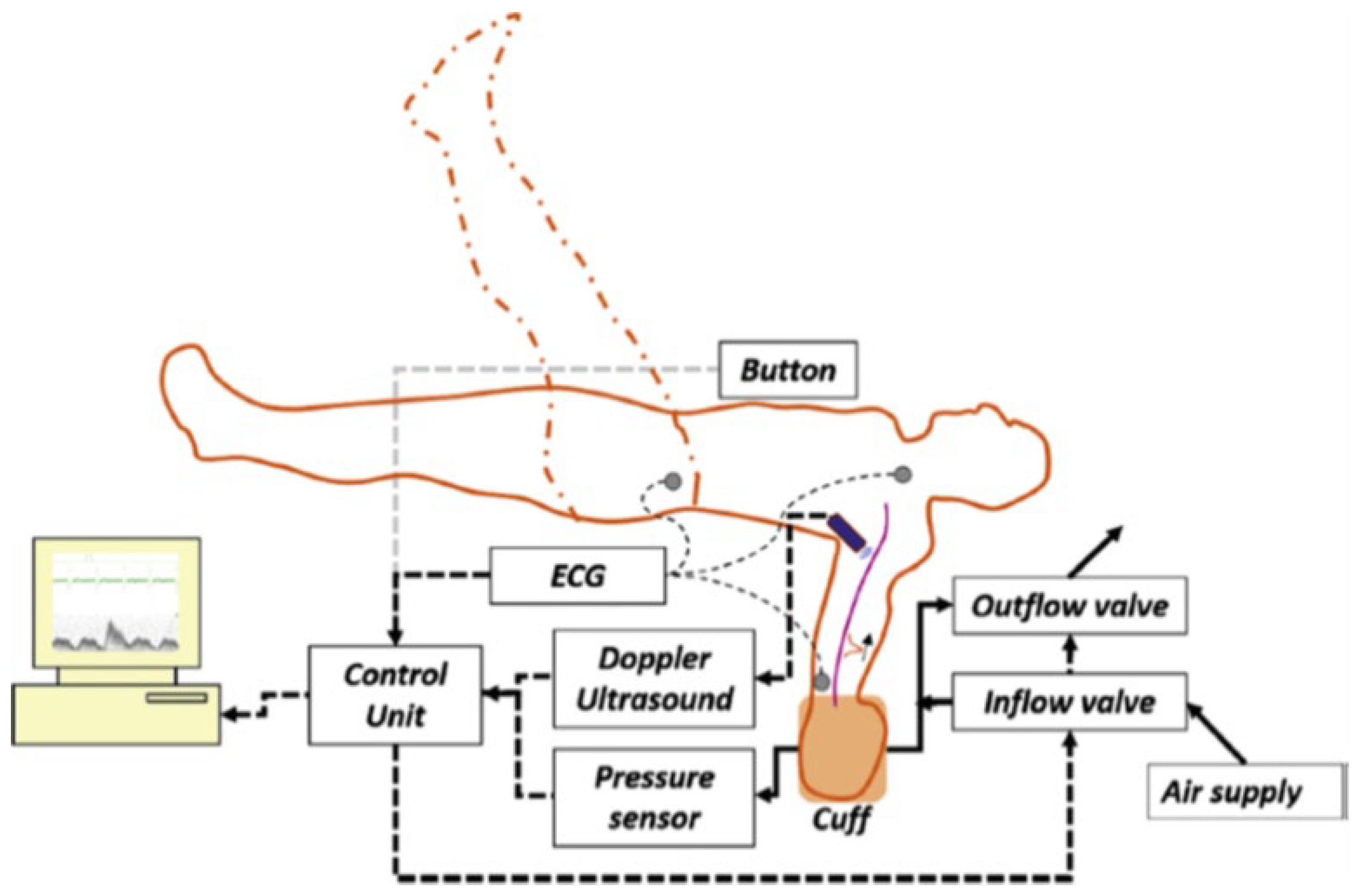 Actuators 11 00328 g011