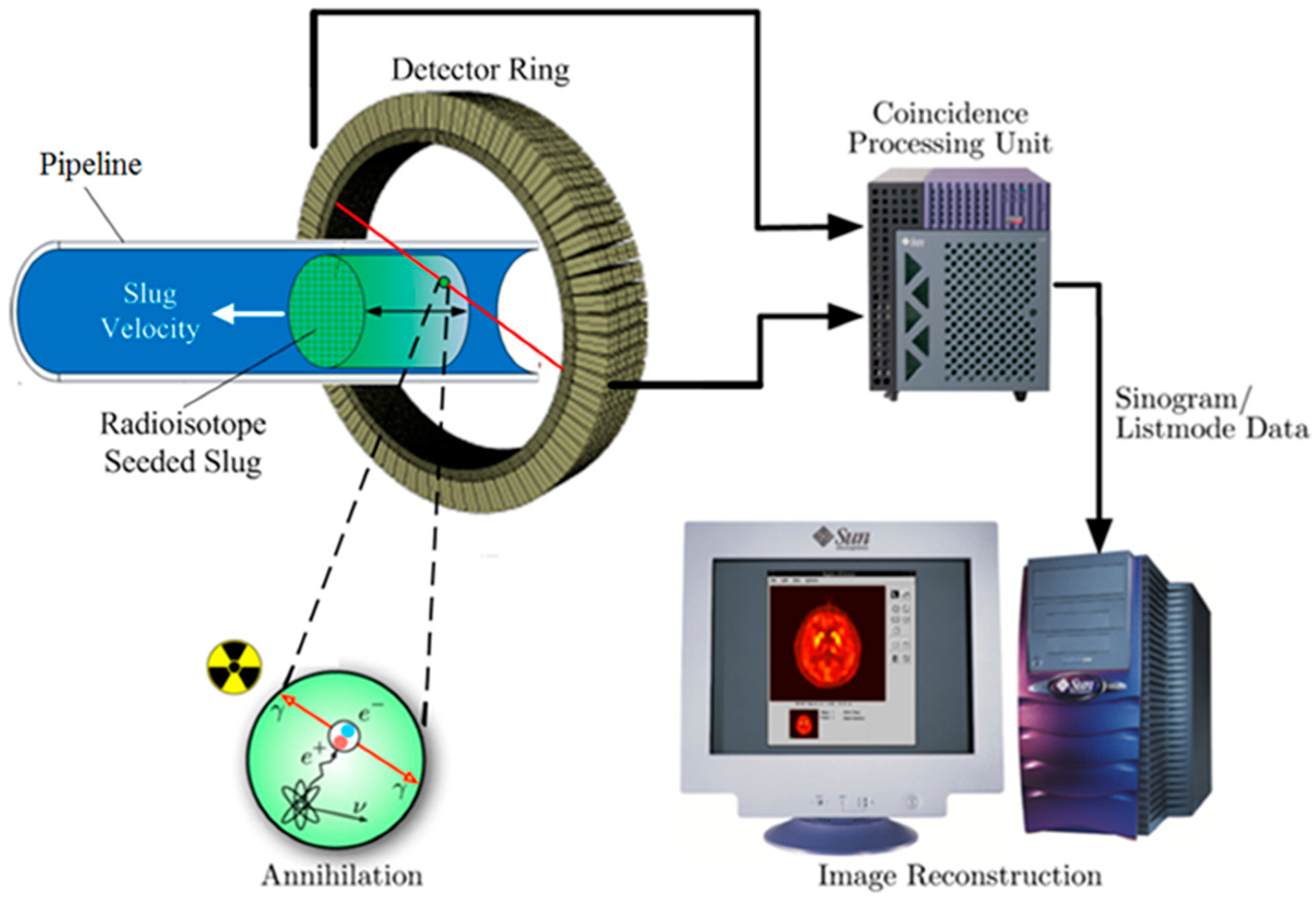 Positron emission tomography - Wikipedia