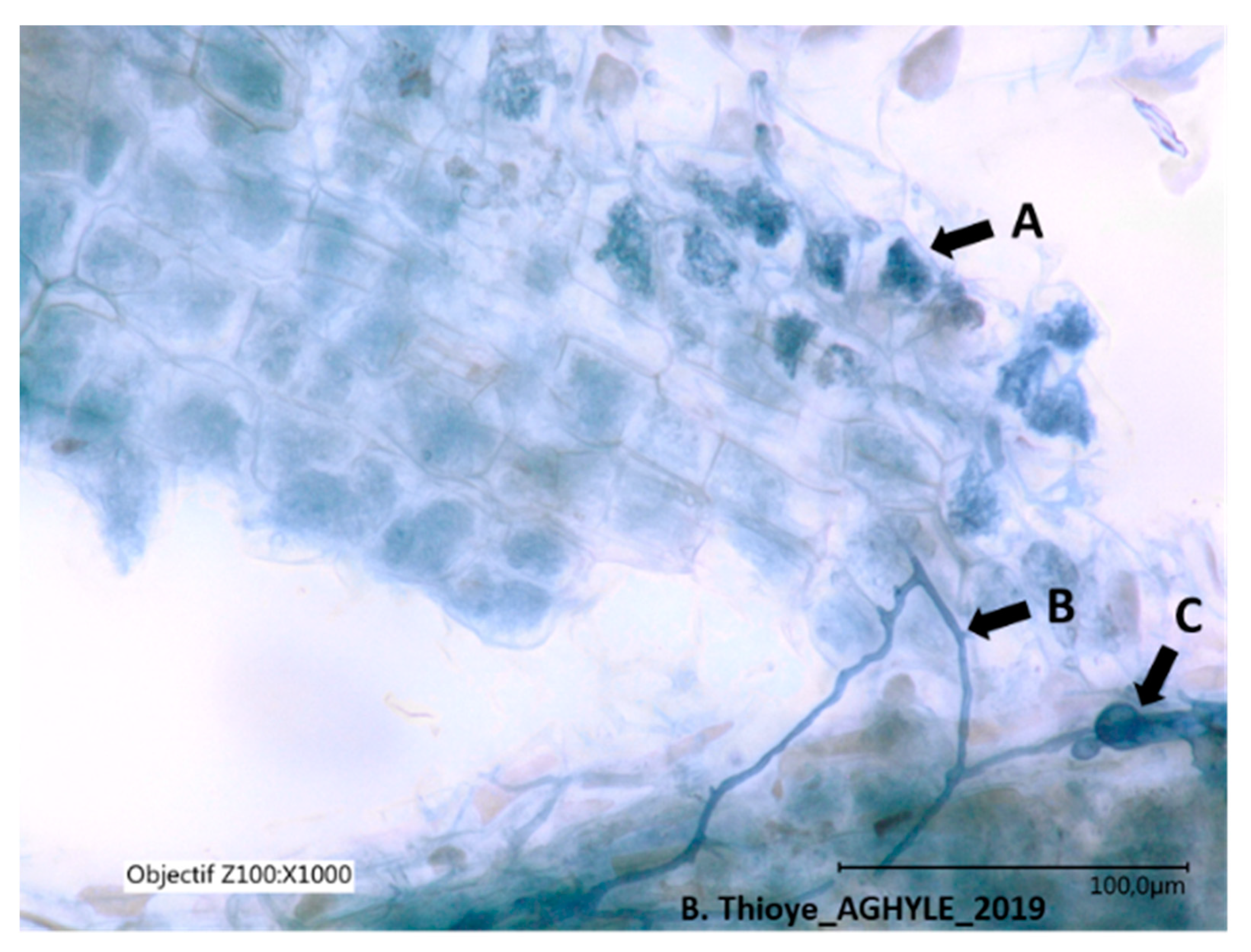 Agriculture | Free Full-Text | Understanding Arbuscular Mycorrhizal  Colonization in Walnut Plantations: The Contribution of Cover Crops and  Soil Microbial Communities