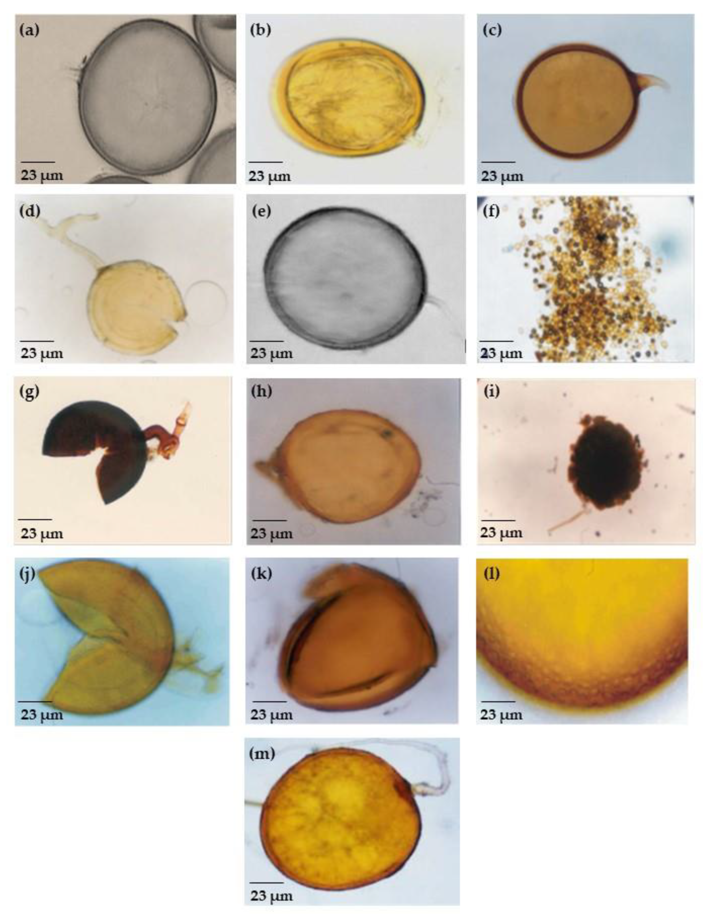 Agronomy Free Full Text Biodiversity Of Am Fungi In Coffee Cultivated On Eroded Soil Html