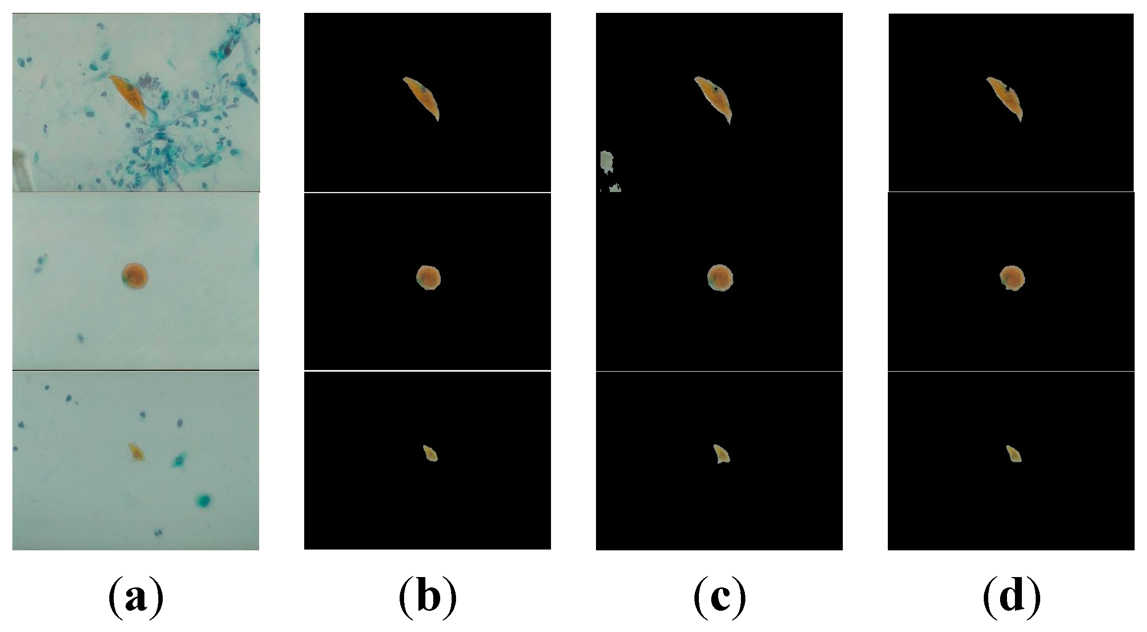 Algorithms | Free Full-Text | Computer Aided Diagnosis System for Early