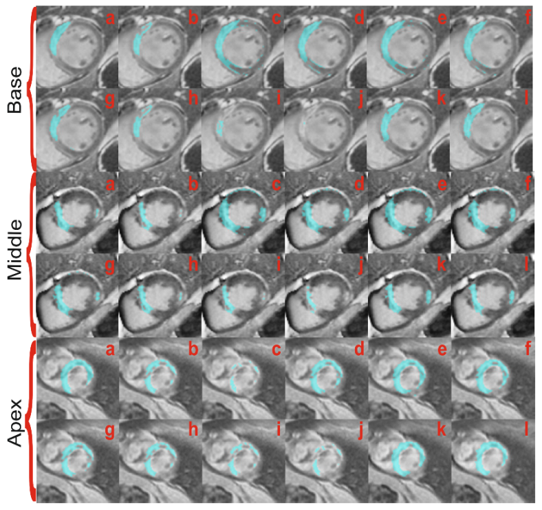 Algorithms 14 00249 g005