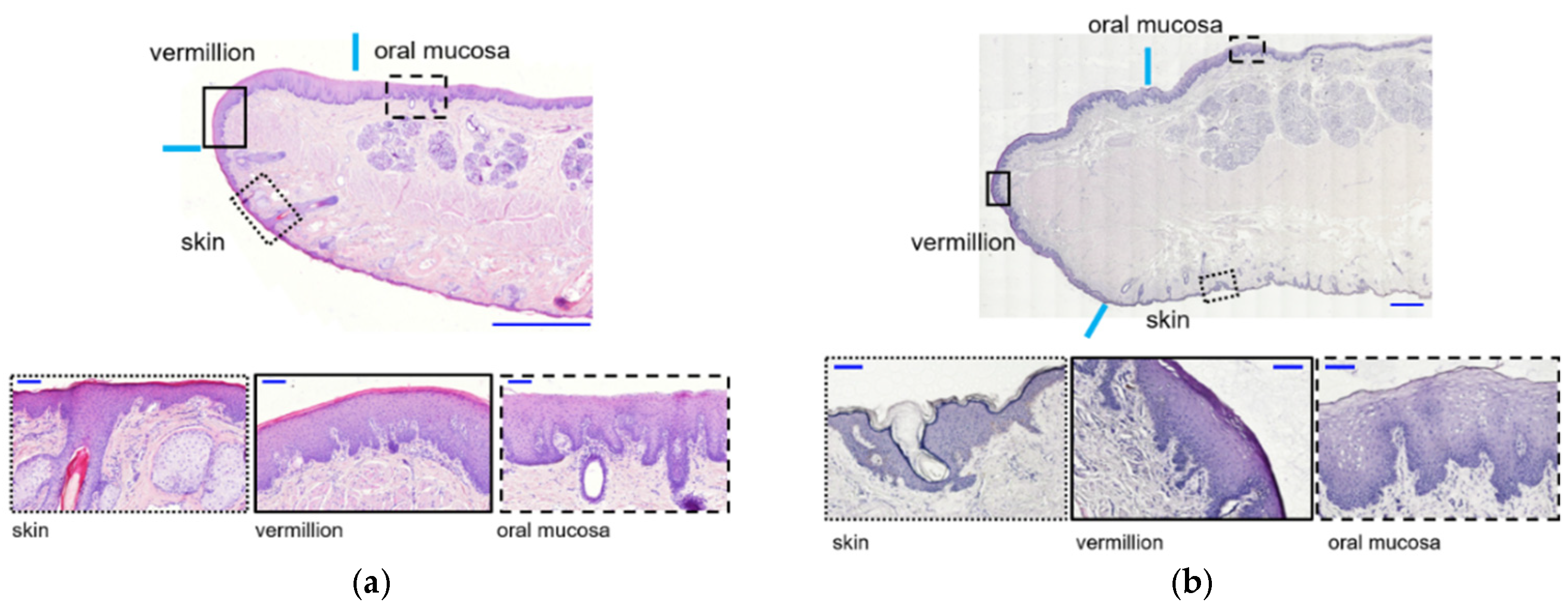 Anatomia | Free Full-Text | Detection of Potential Markers for Lip Vermilion  Epithelium in Japanese Macaques Based on the Results of Gene Expression  Profile