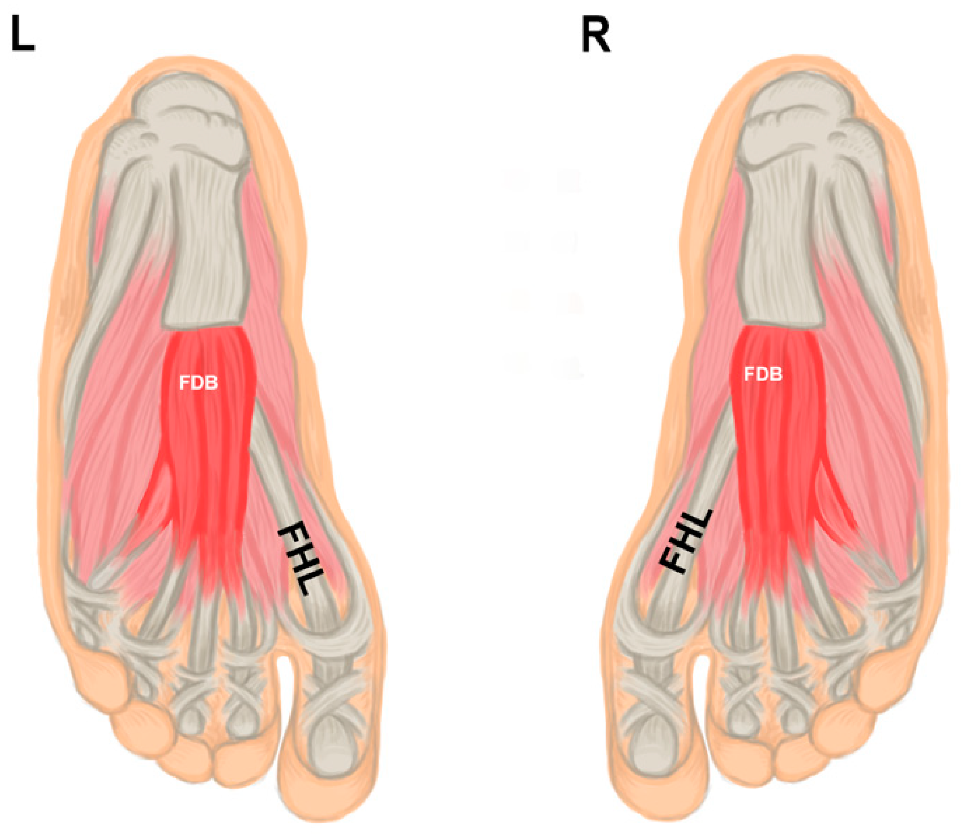 Anatomia | Free Full-Text | A Missing Flexor Digitorum Brevis Tendon and  Its Relationship to Sex and Ancestry: Evaluation in Hispanic Population