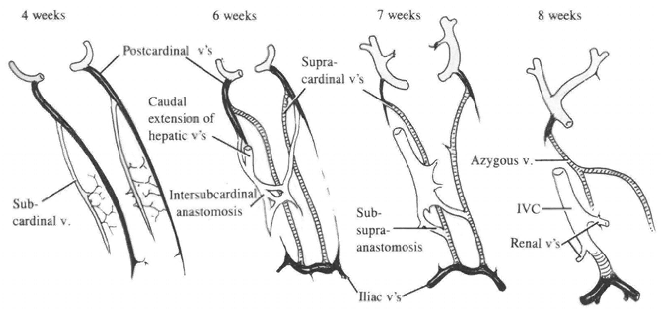 Anatomia Free Full Text Duplicated Inferior Vena Cava In A 69 Year Old White Female Donor 